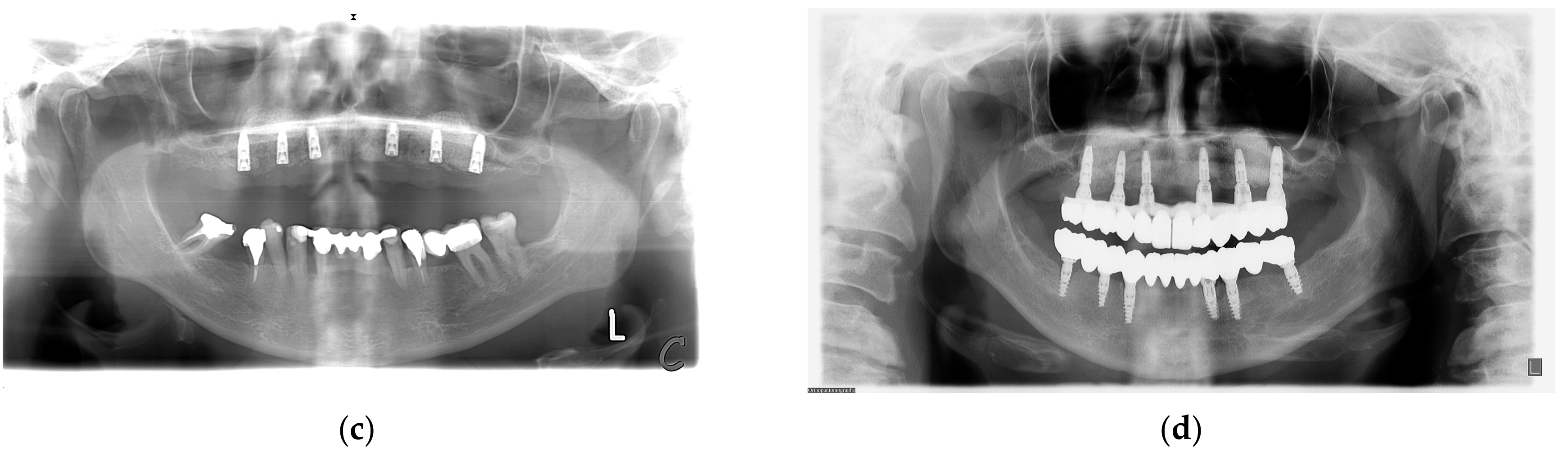 Medicina 59 00494 g003b Medicina 59 00494 g003b