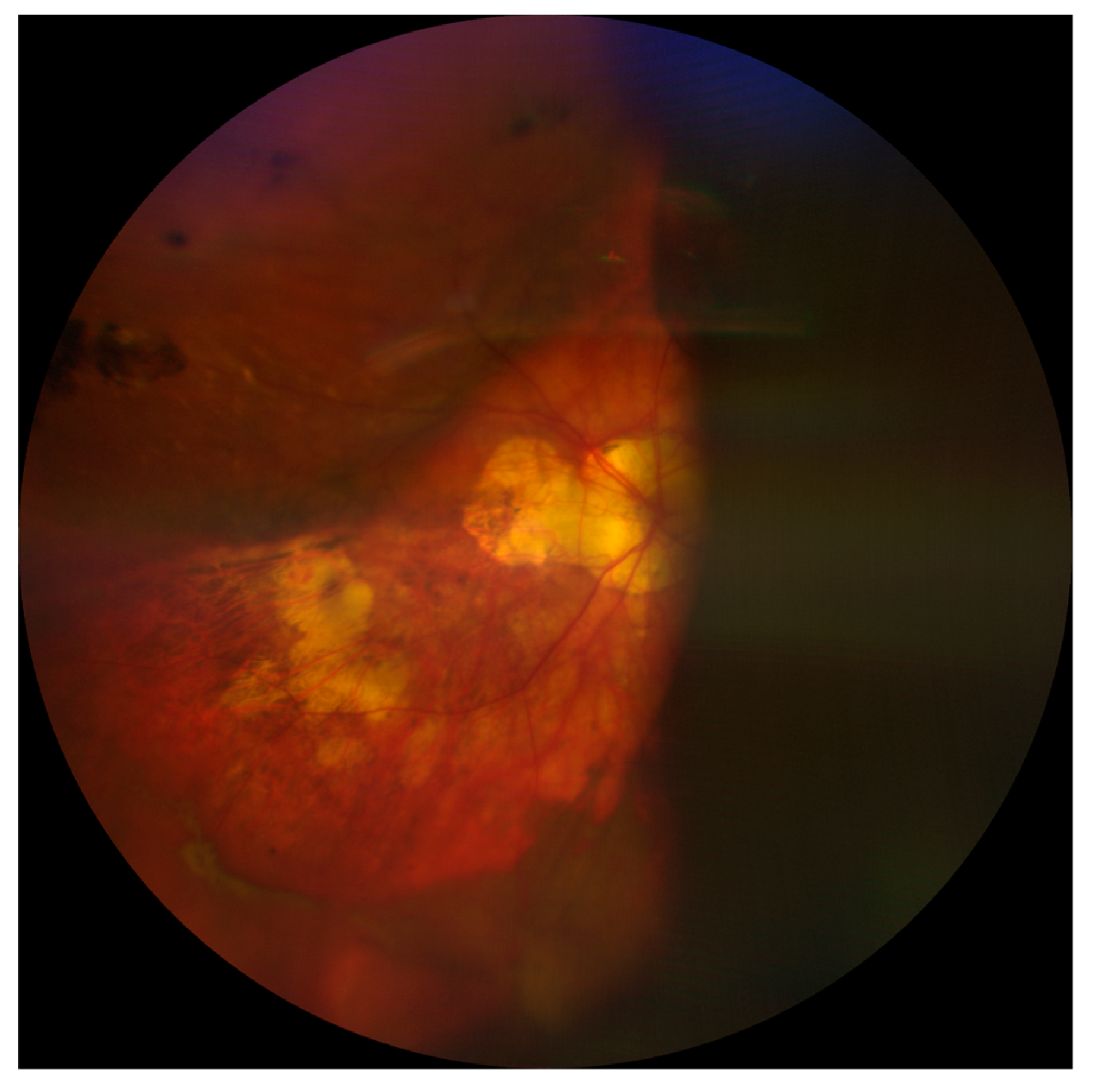 Medicina 59 00583 g002 Medicina 59 00583 g002