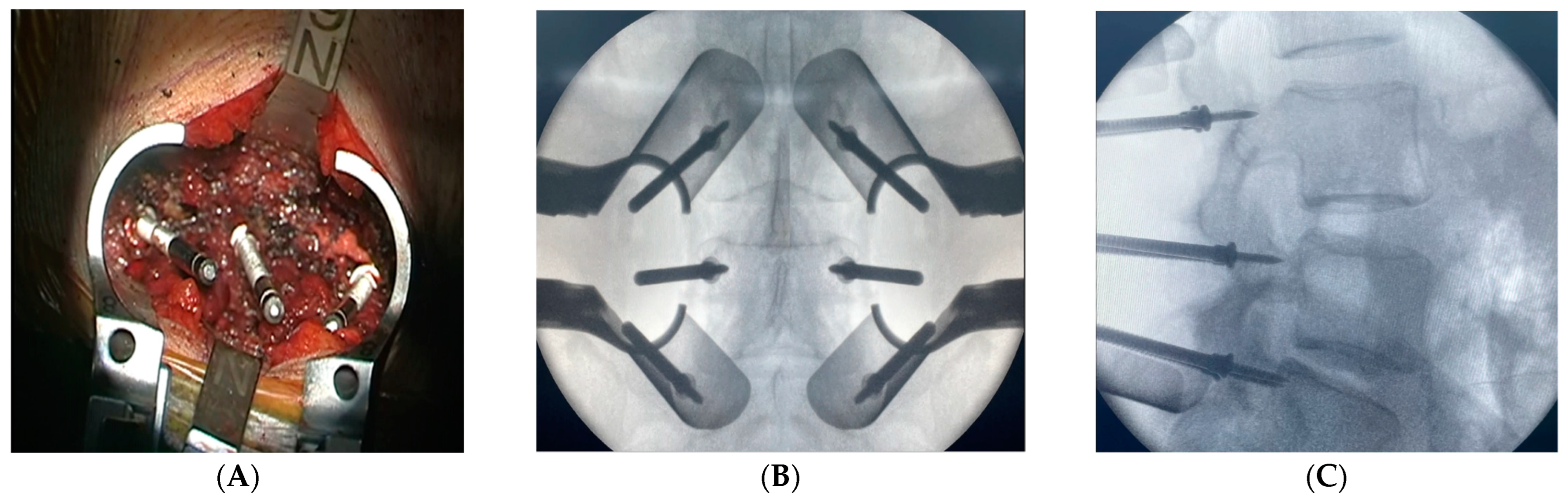 Medicina 59 00585 g002 Medicina 59 00585 g002