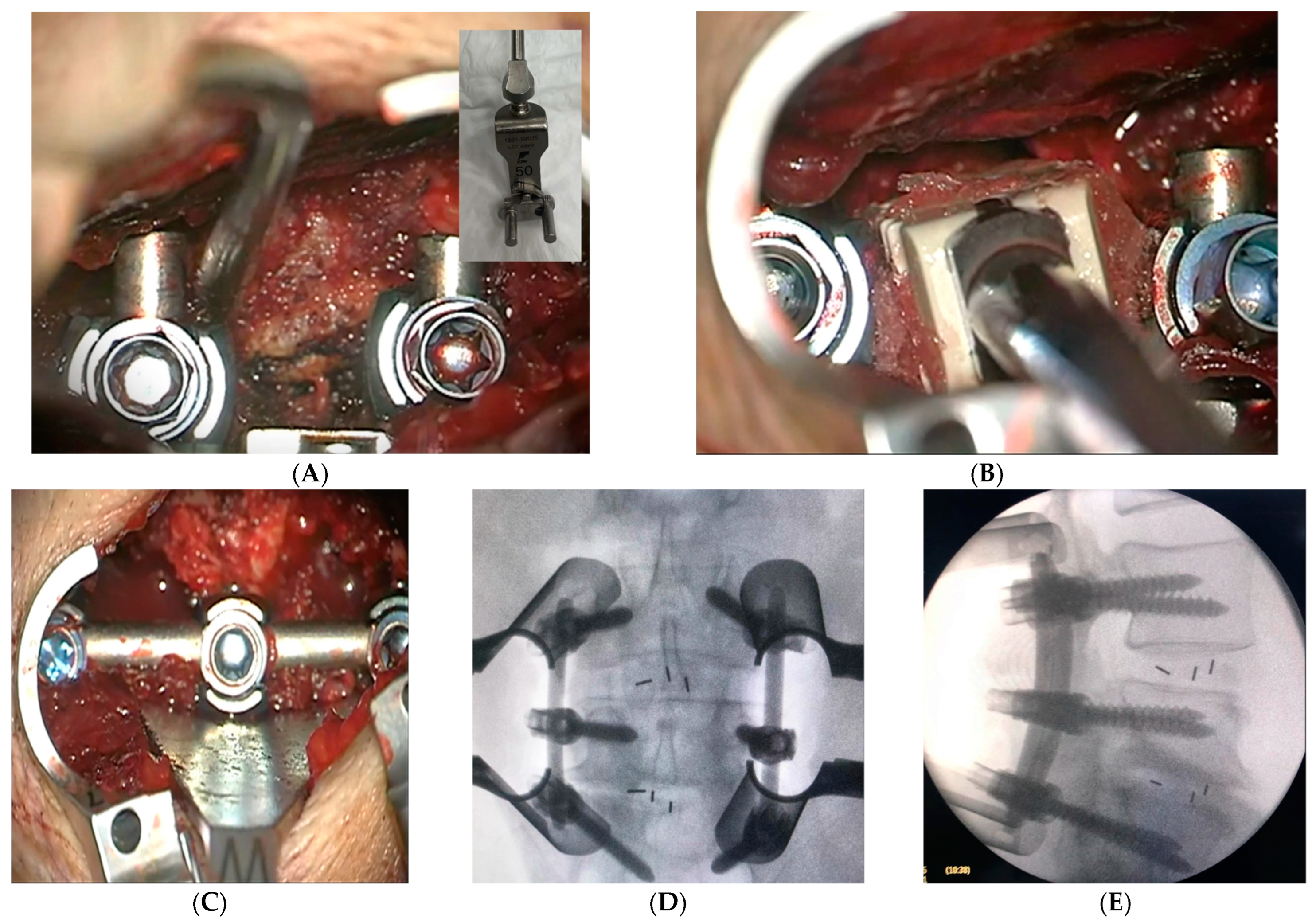Medicina 59 00585 g004 Medicina 59 00585 g004