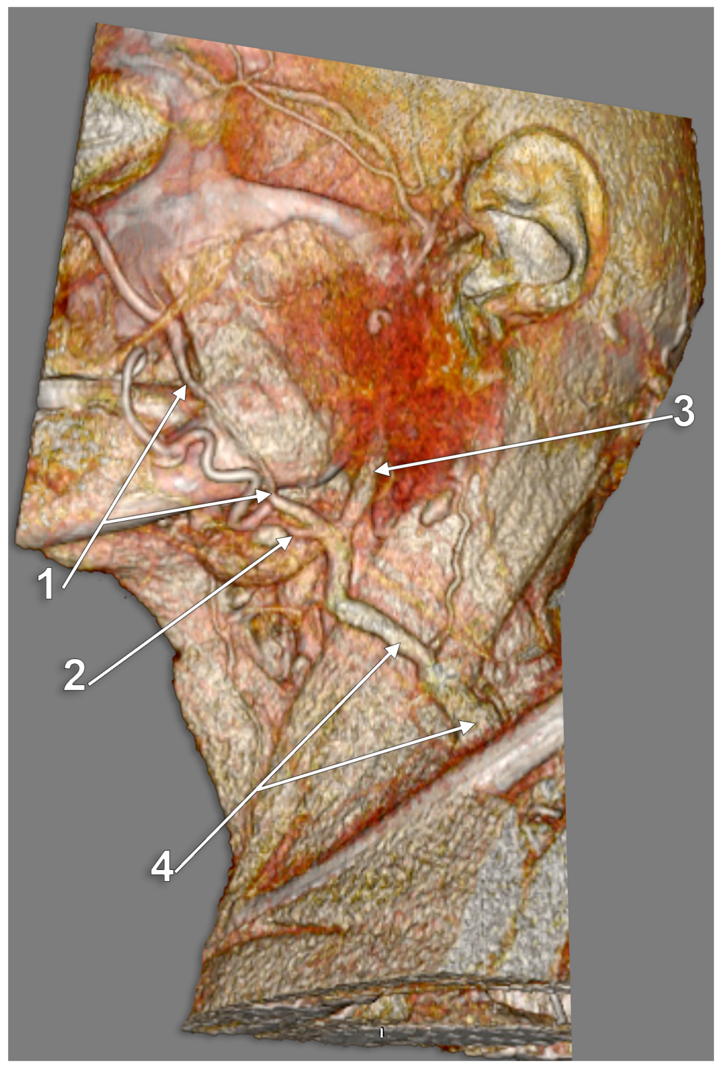 external jugular vein cadaver