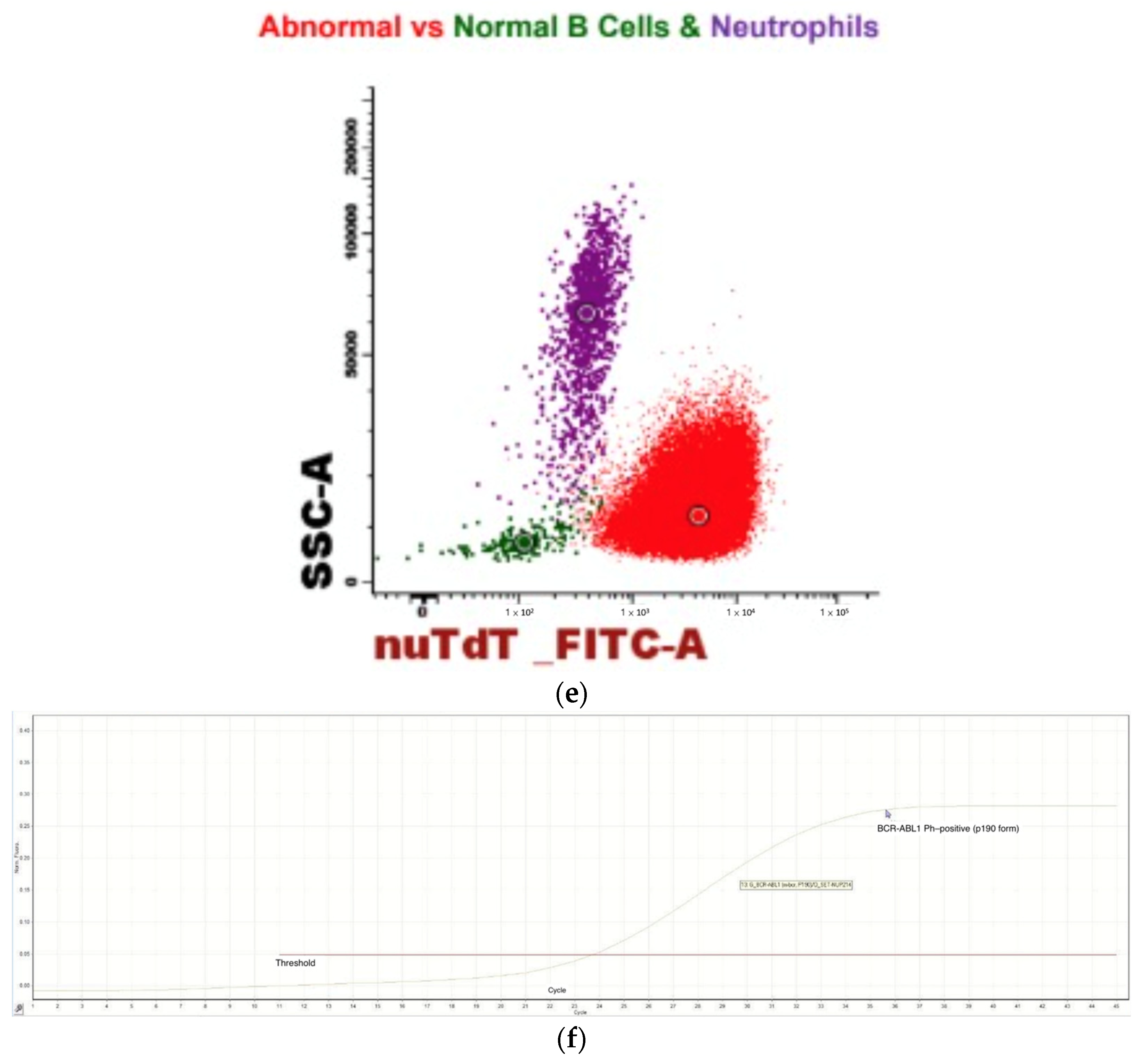 Ph-Positive B-Cell Acute Lymphoblastic Leukemia Occurring After Receipt ...