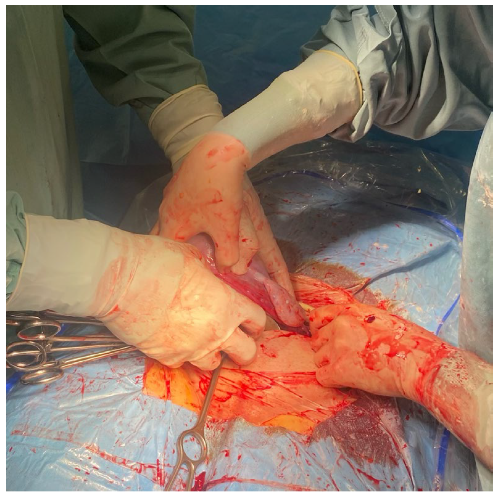 Medicina 59 00641 g002 Medicina 59 00641 g002