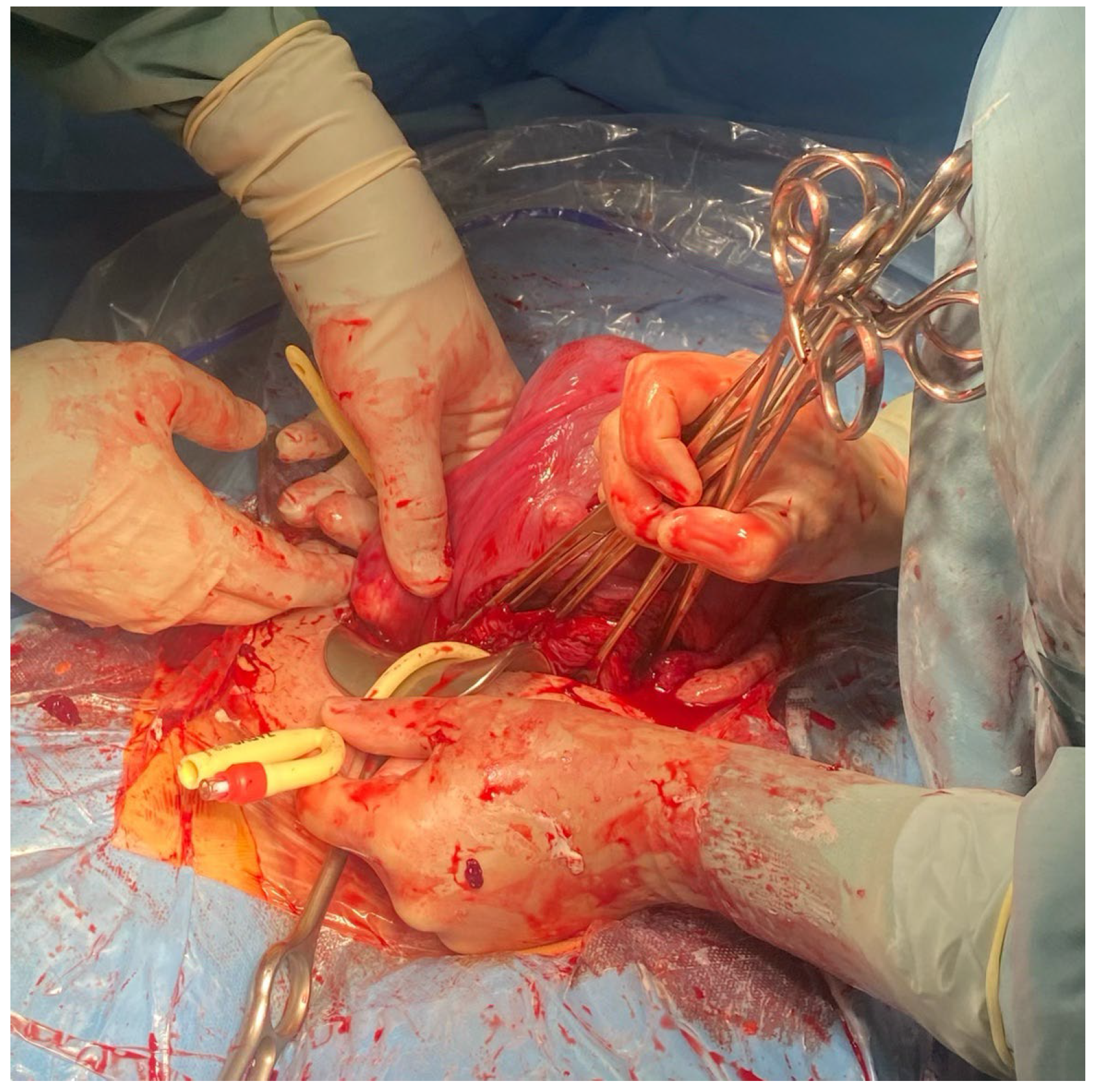 Medicina 59 00641 g003 Medicina 59 00641 g003