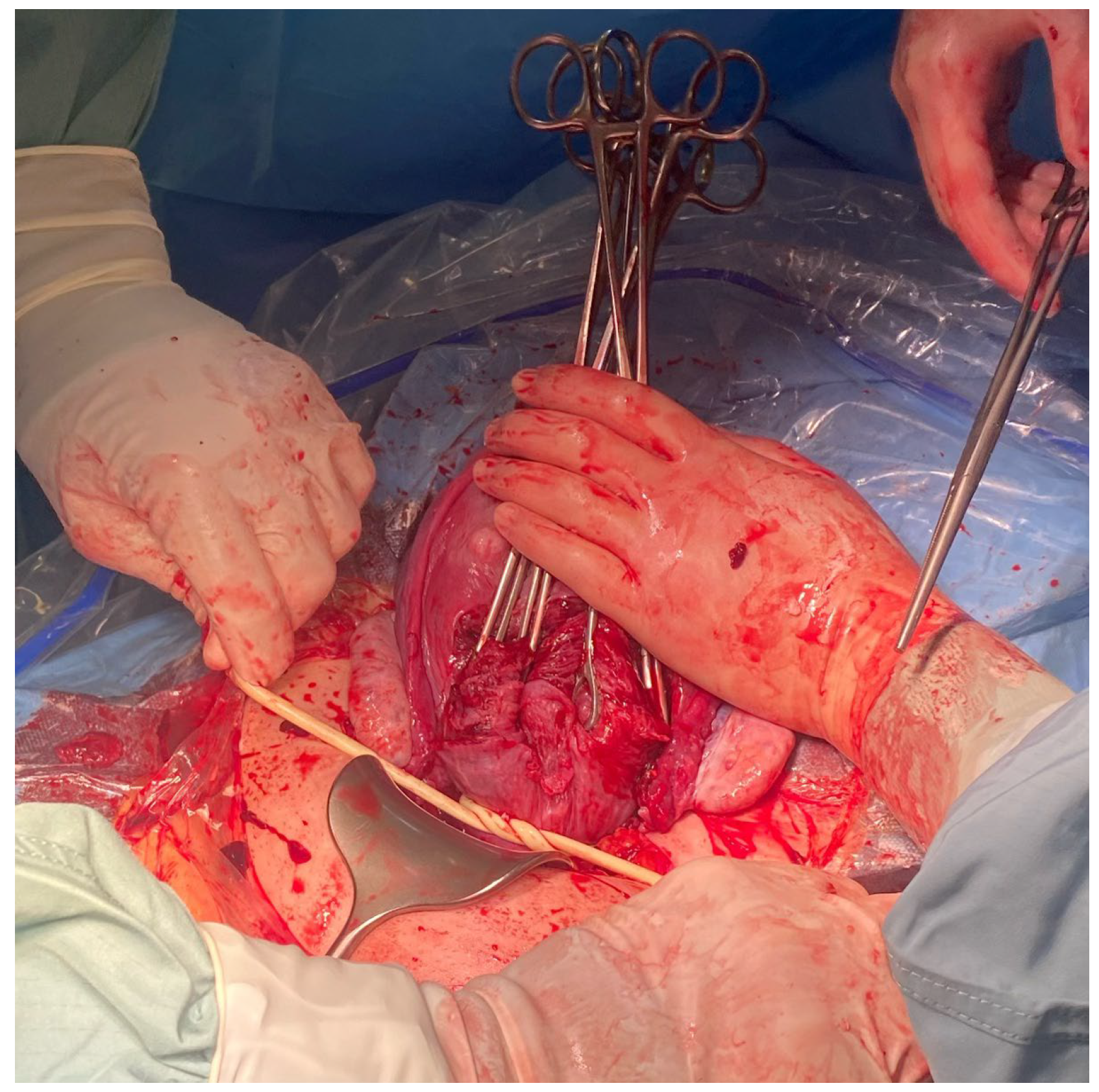 Medicina 59 00641 g005 Medicina 59 00641 g005