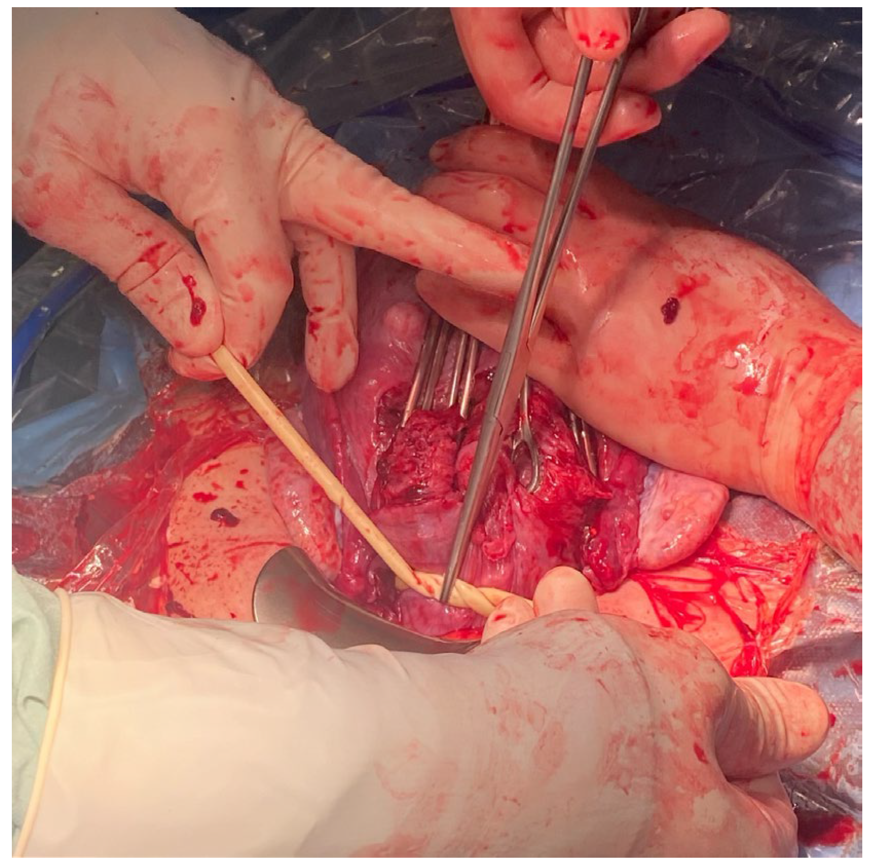 Medicina 59 00641 g006 Medicina 59 00641 g006