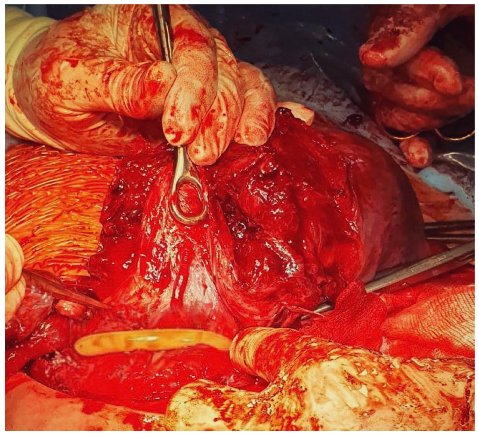 Medicina 59 00641 g008 Medicina 59 00641 g008