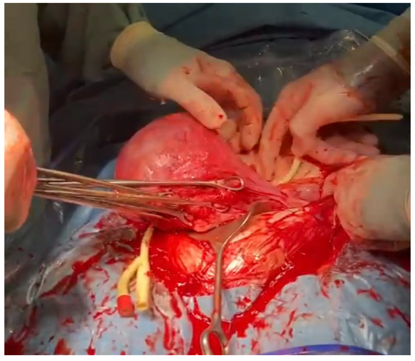 Medicina 59 00641 g009 Medicina 59 00641 g009