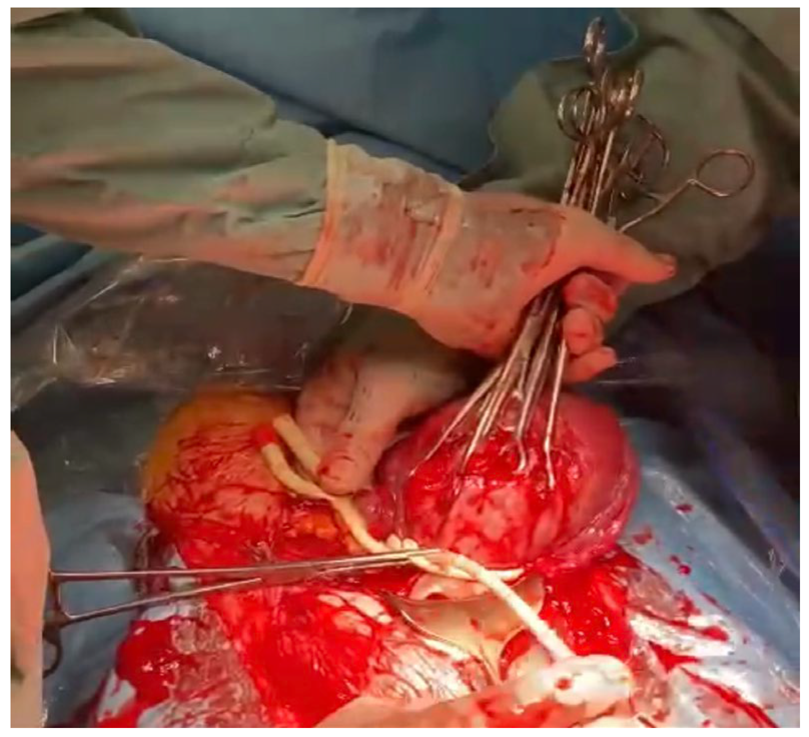 Medicina 59 00641 g010 Medicina 59 00641 g010