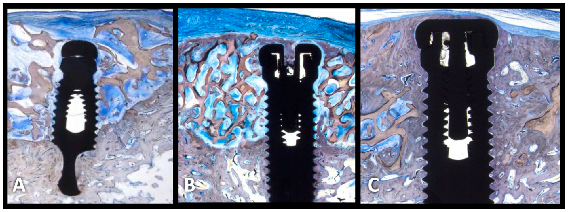 Medicina 59 00676 g002 Medicina 59 00676 g002