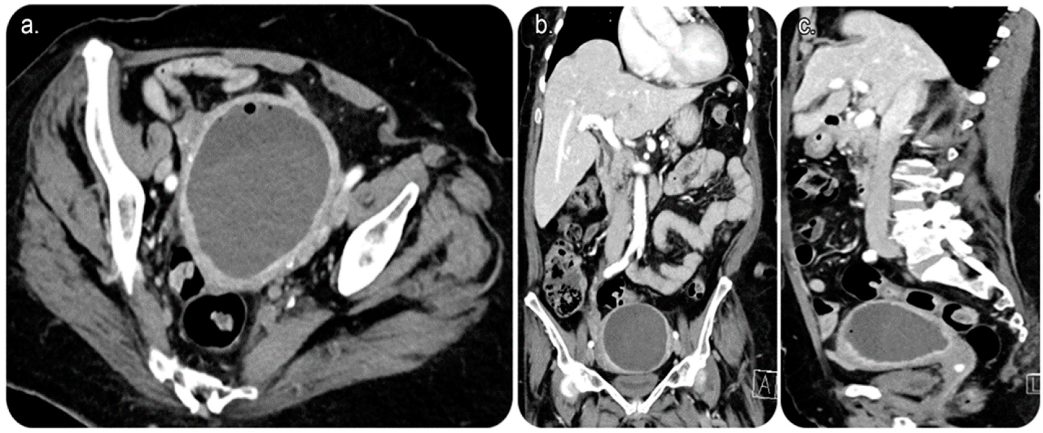 Medicina 59 00689 g001 Medicina 59 00689 g001