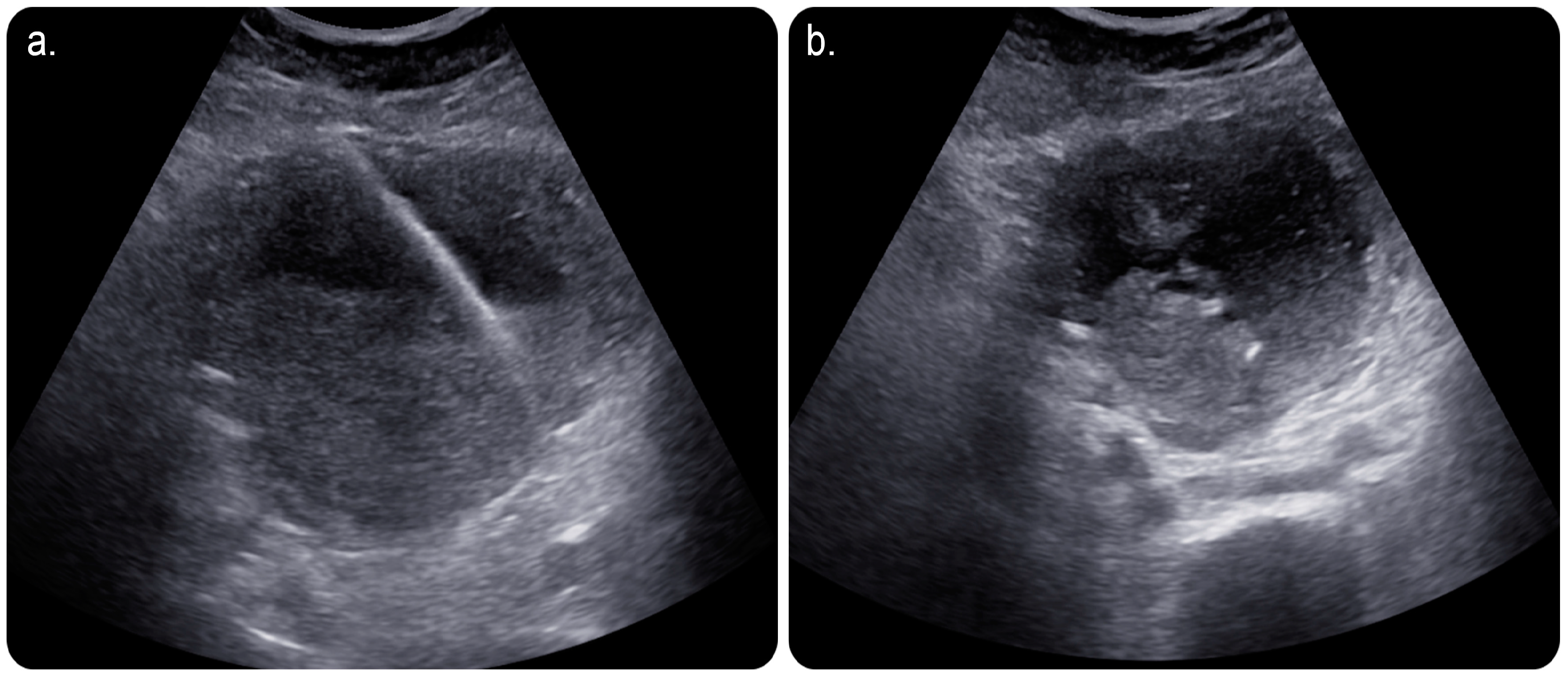 Medicina 59 00689 g002 Medicina 59 00689 g002