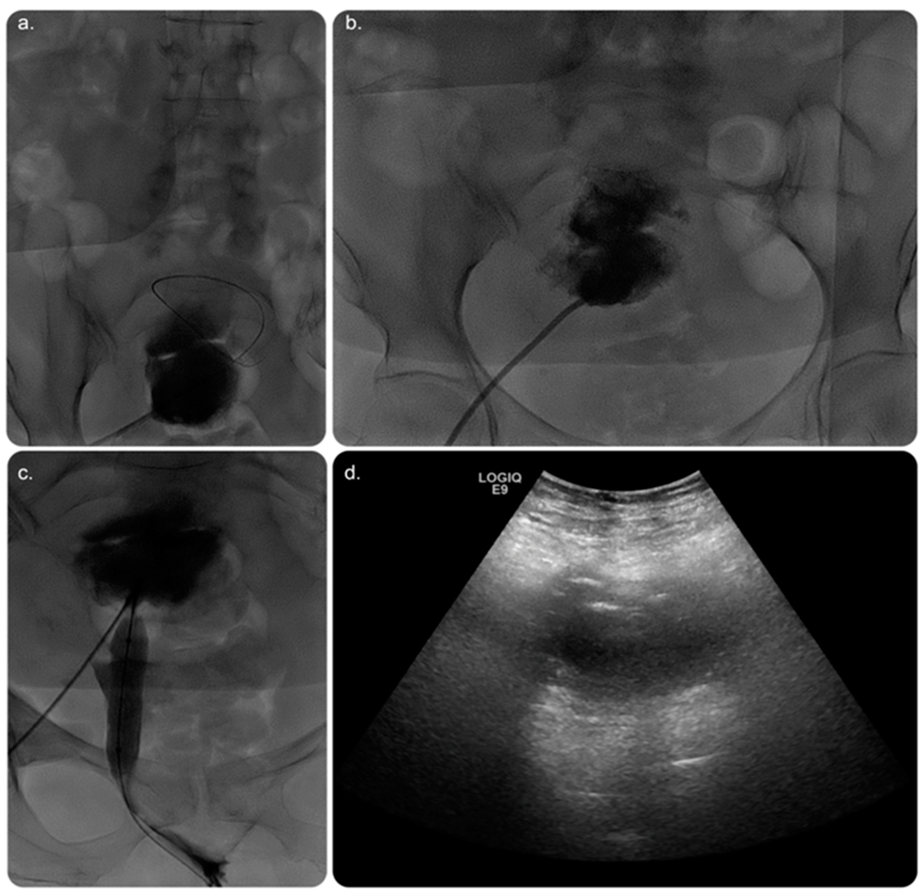 Medicina 59 00689 g004 Medicina 59 00689 g004