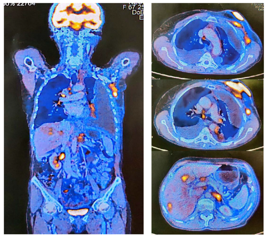 Medicina 59 00696 g002 Medicina 59 00696 g002