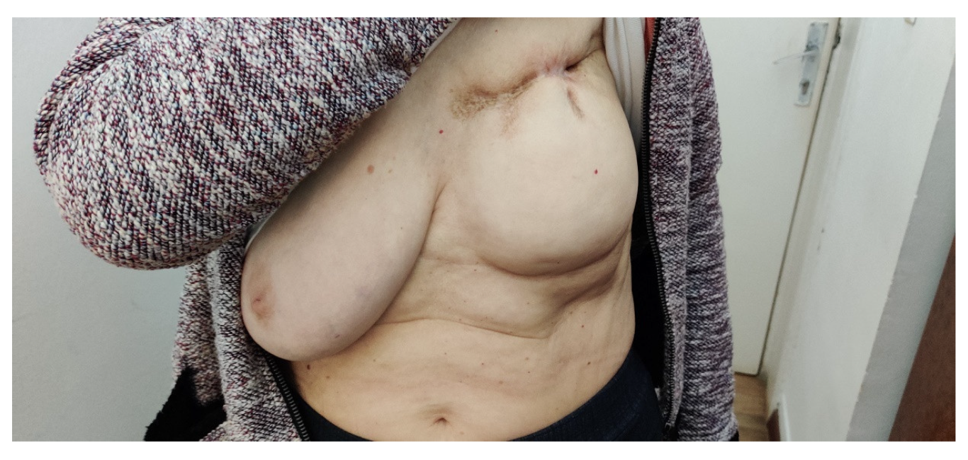 Medicina 59 00696 g006 Medicina 59 00696 g006