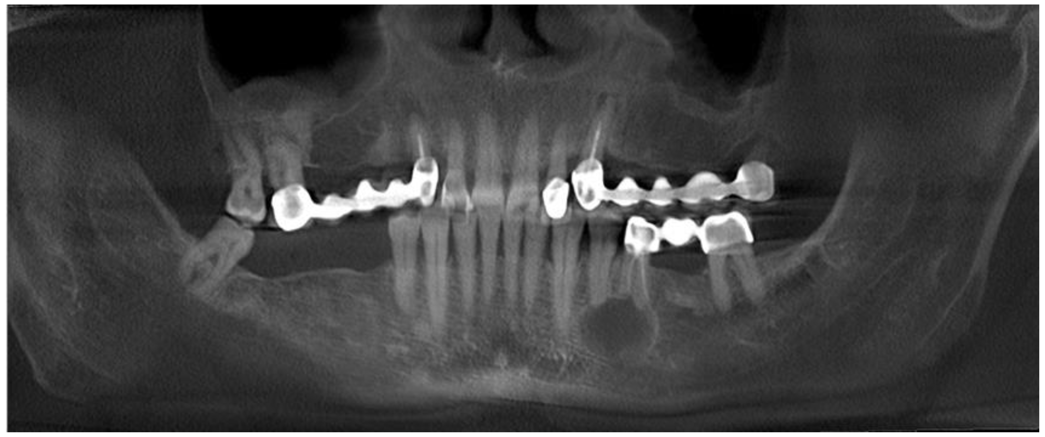 Medicina 59 00711 g002 Medicina 59 00711 g002