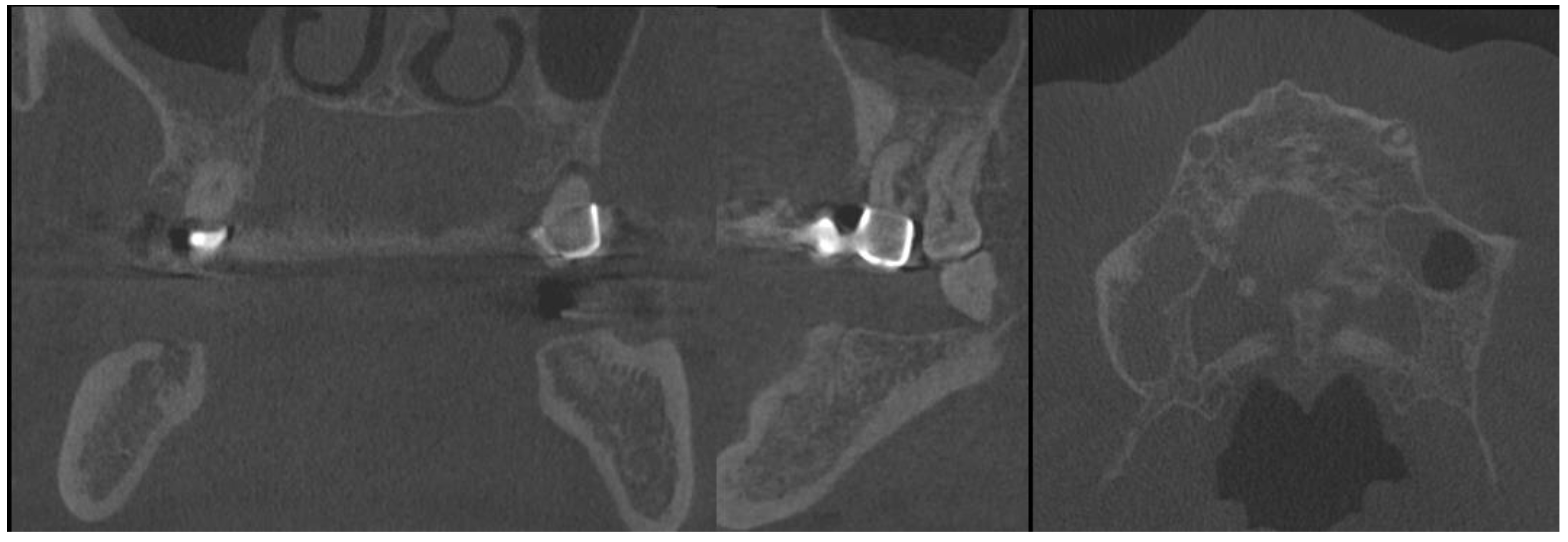 Medicina 59 00711 g003 Medicina 59 00711 g003