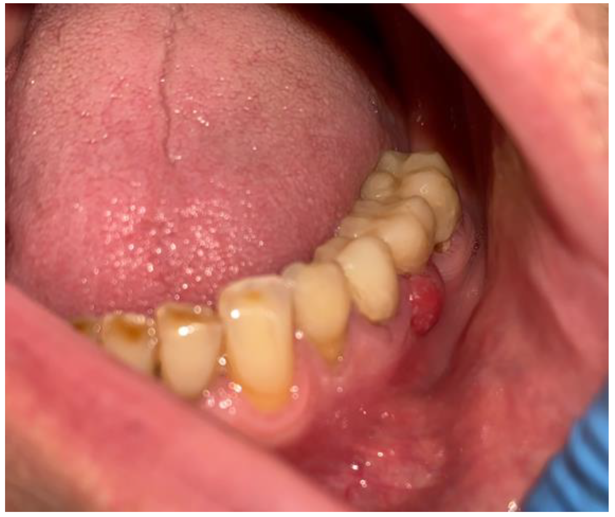 Medicina 59 00711 g005 Medicina 59 00711 g005