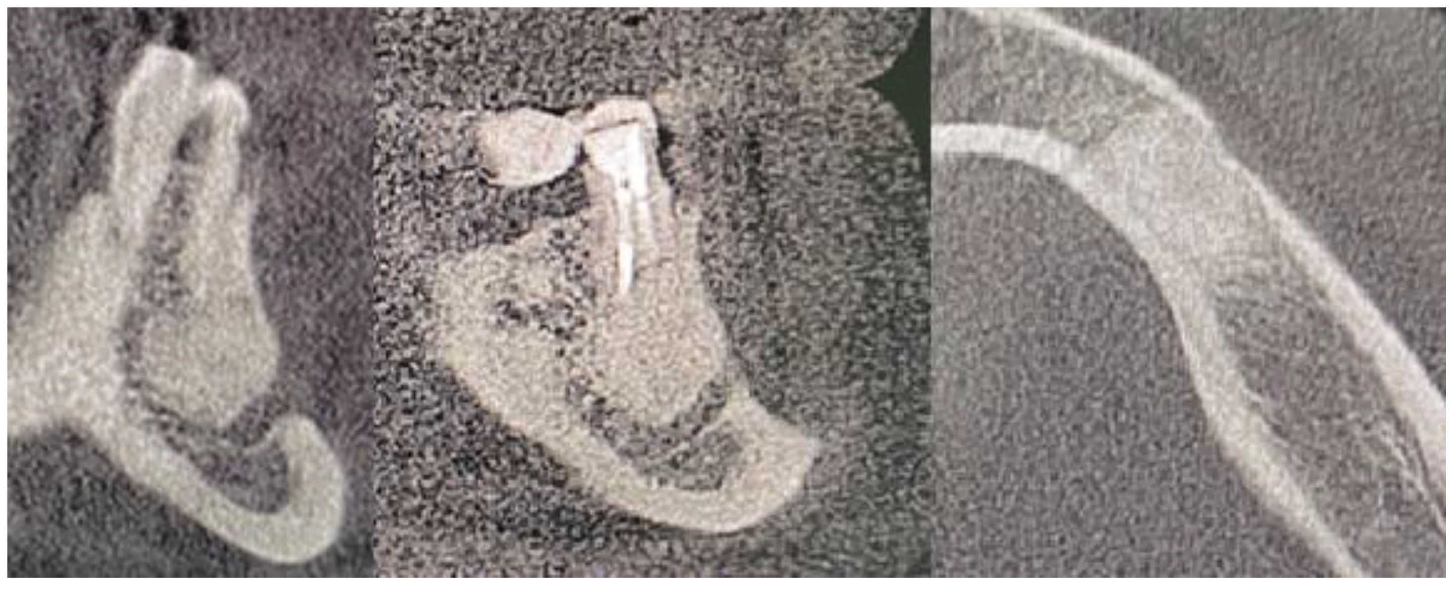 Medicina 59 00711 g010 Medicina 59 00711 g010