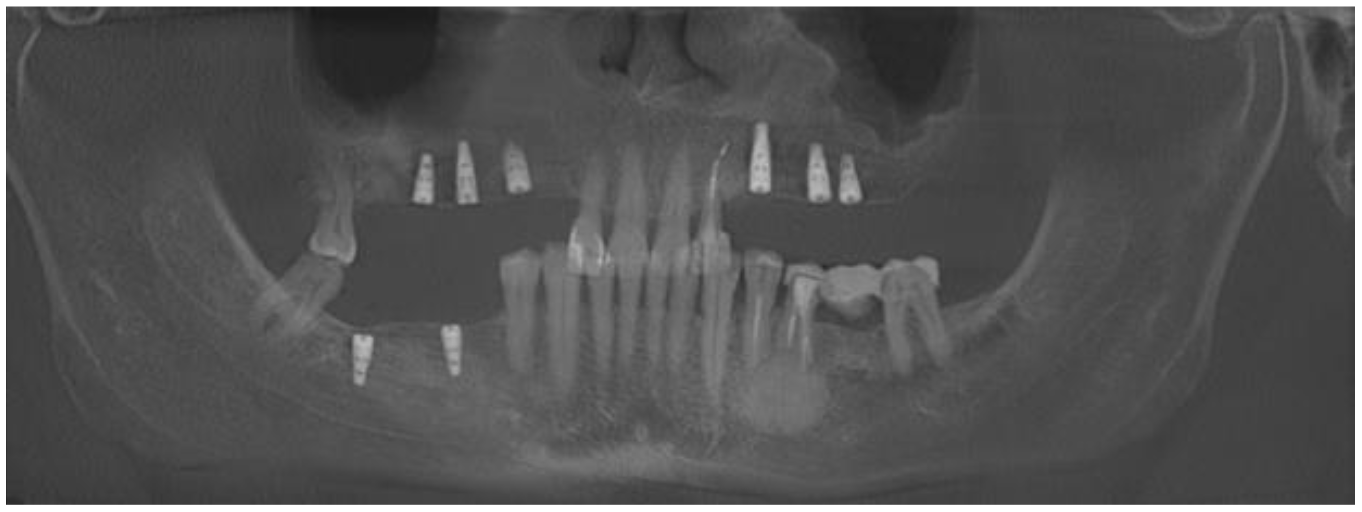 Medicina 59 00711 g011 Medicina 59 00711 g011
