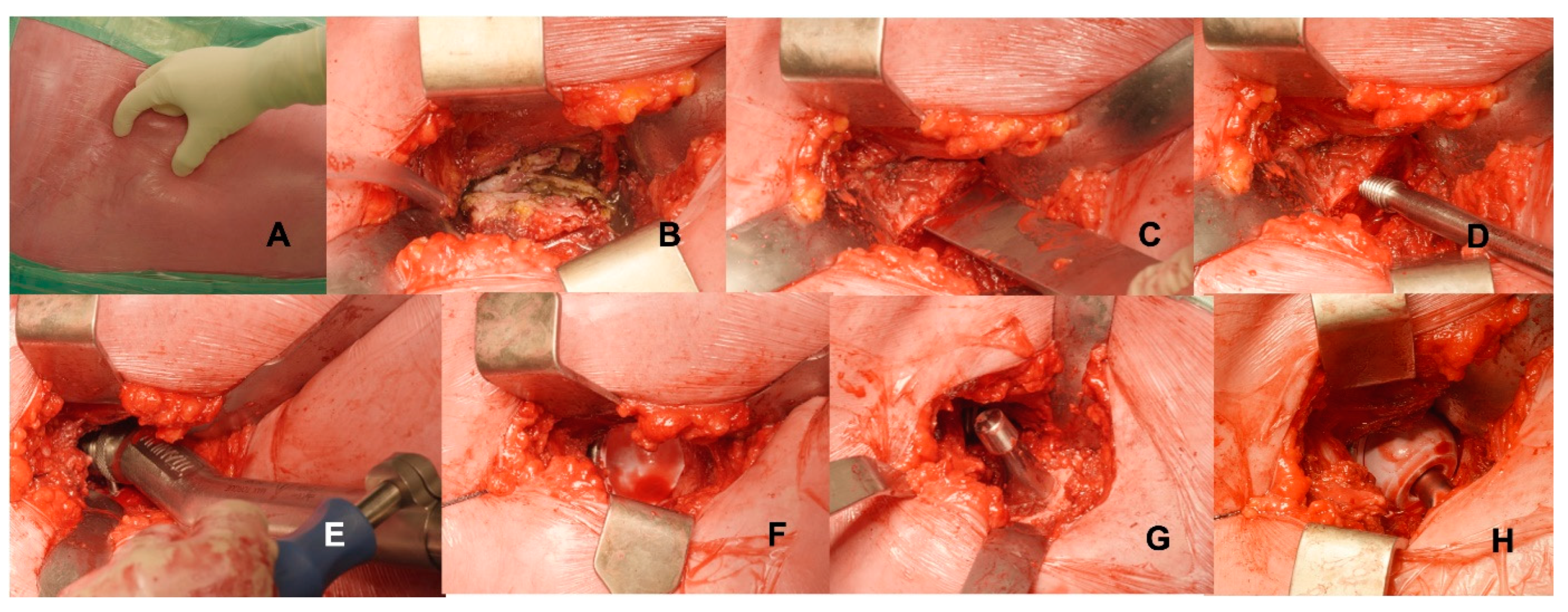 Medicina 59 00769 g003 Medicina 59 00769 g003