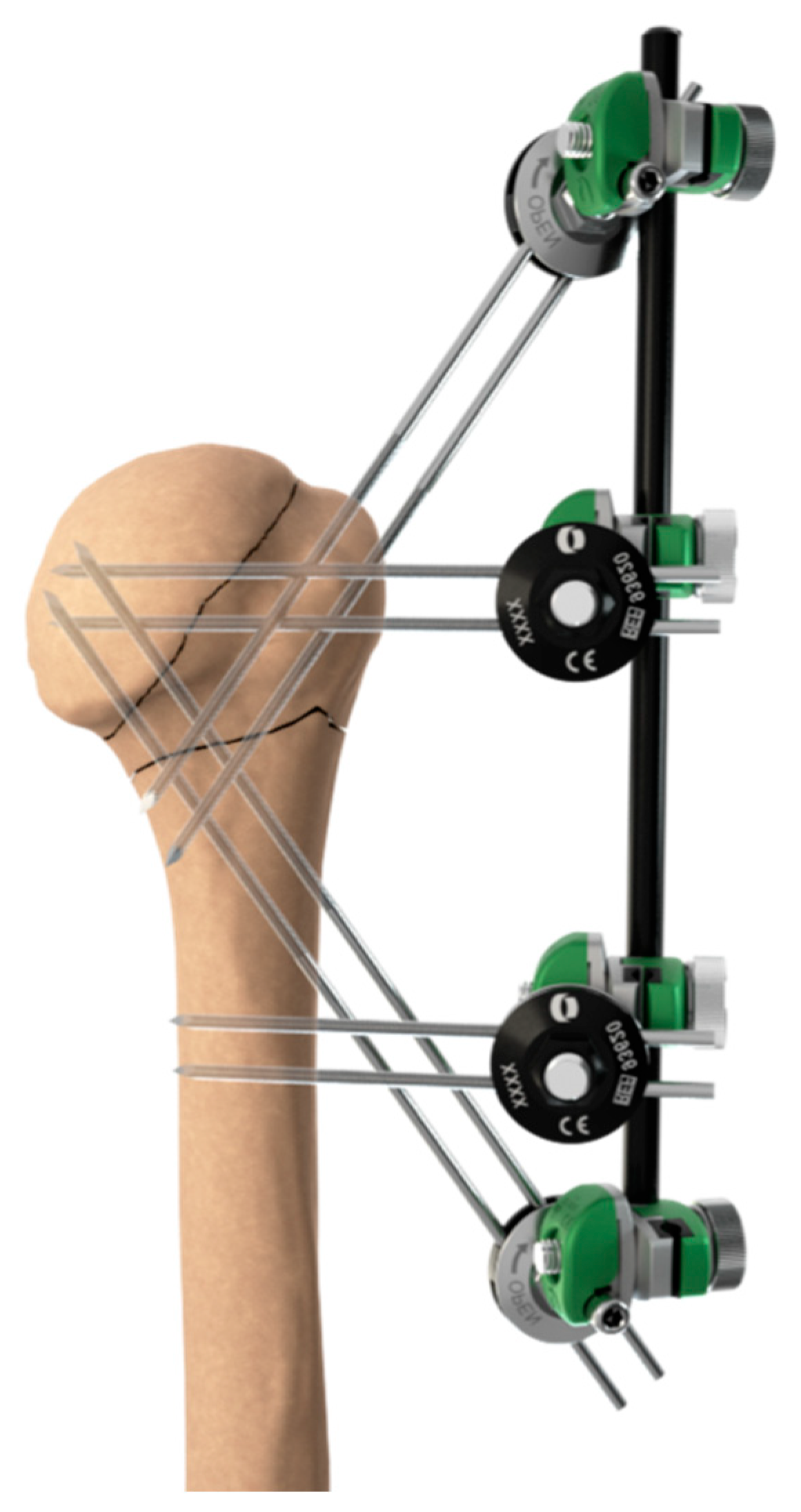 Medicina 59 00772 g003 Medicina 59 00772 g003