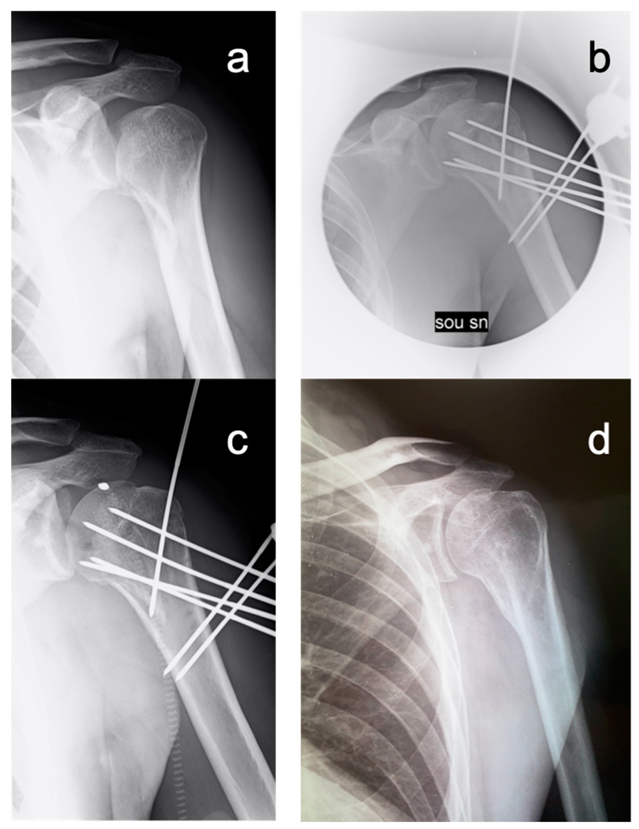 Medicina 59 00772 g004 Medicina 59 00772 g004