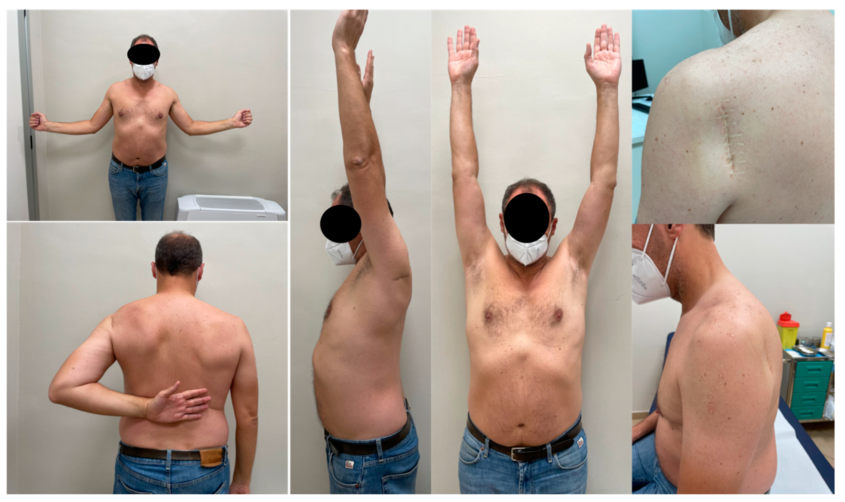 Medicina 59 00772 g005 Medicina 59 00772 g005