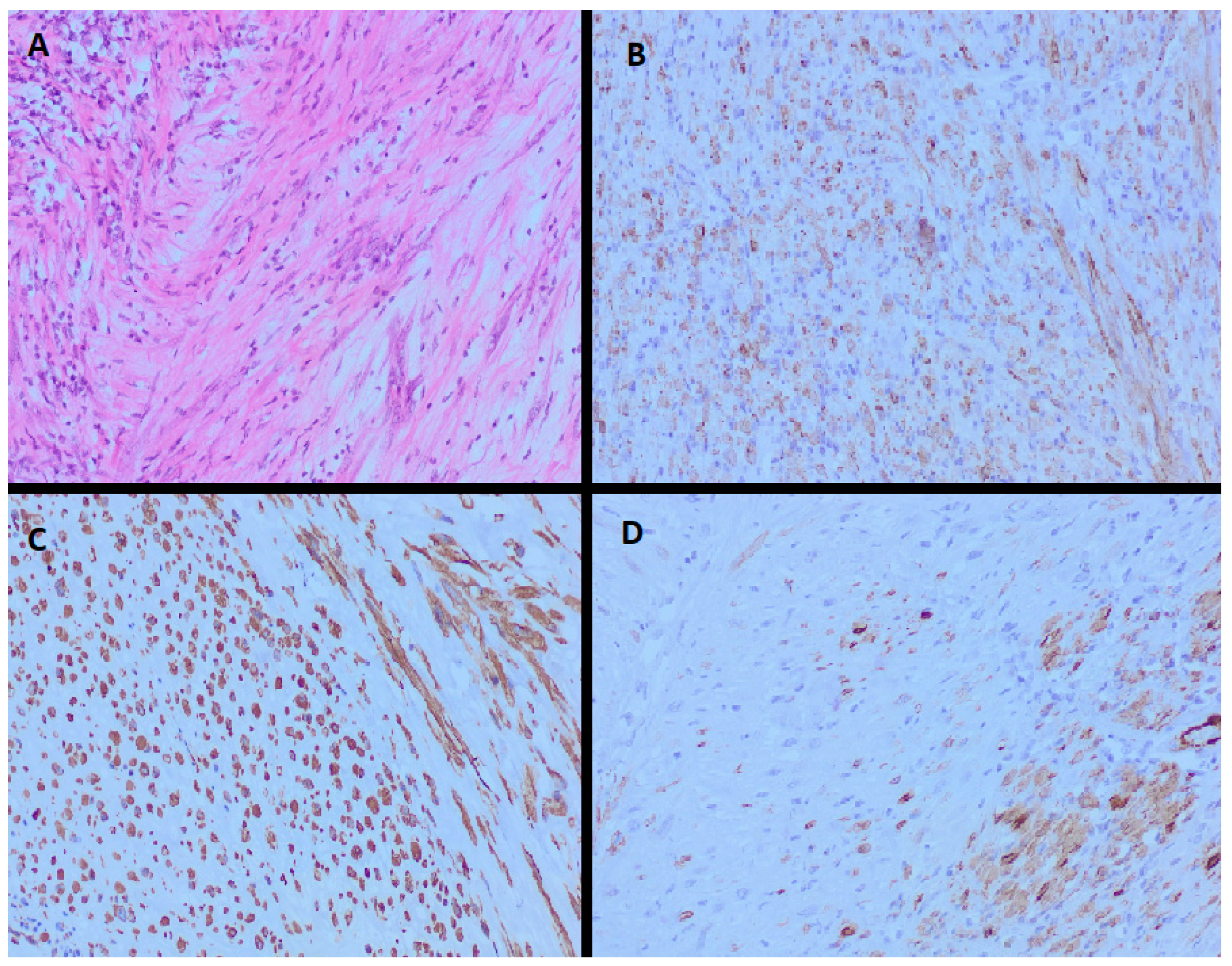 Histological presentation of bladder smooth muscle preparations from