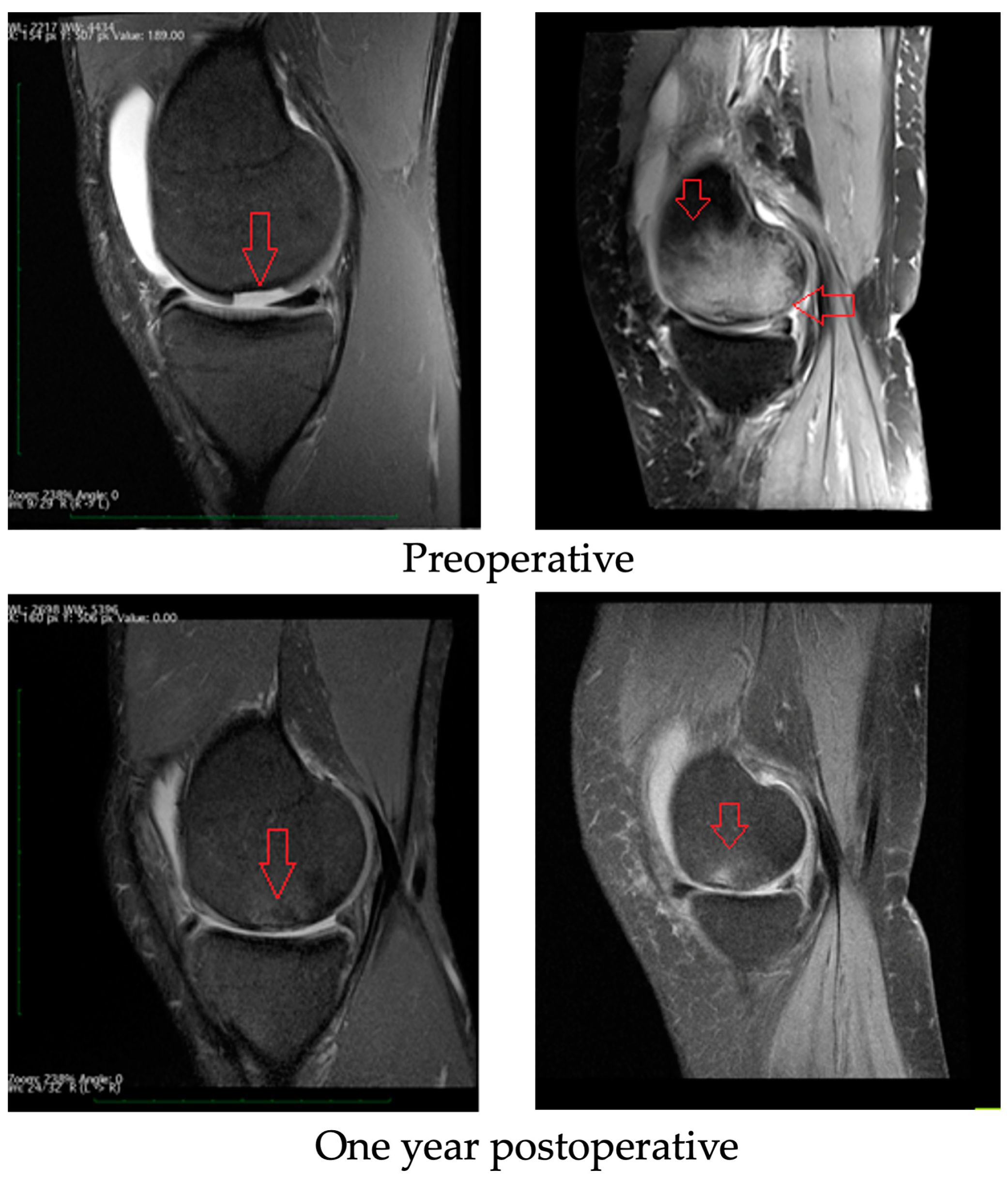 Medicina 59 00804 g006 Medicina 59 00804 g006