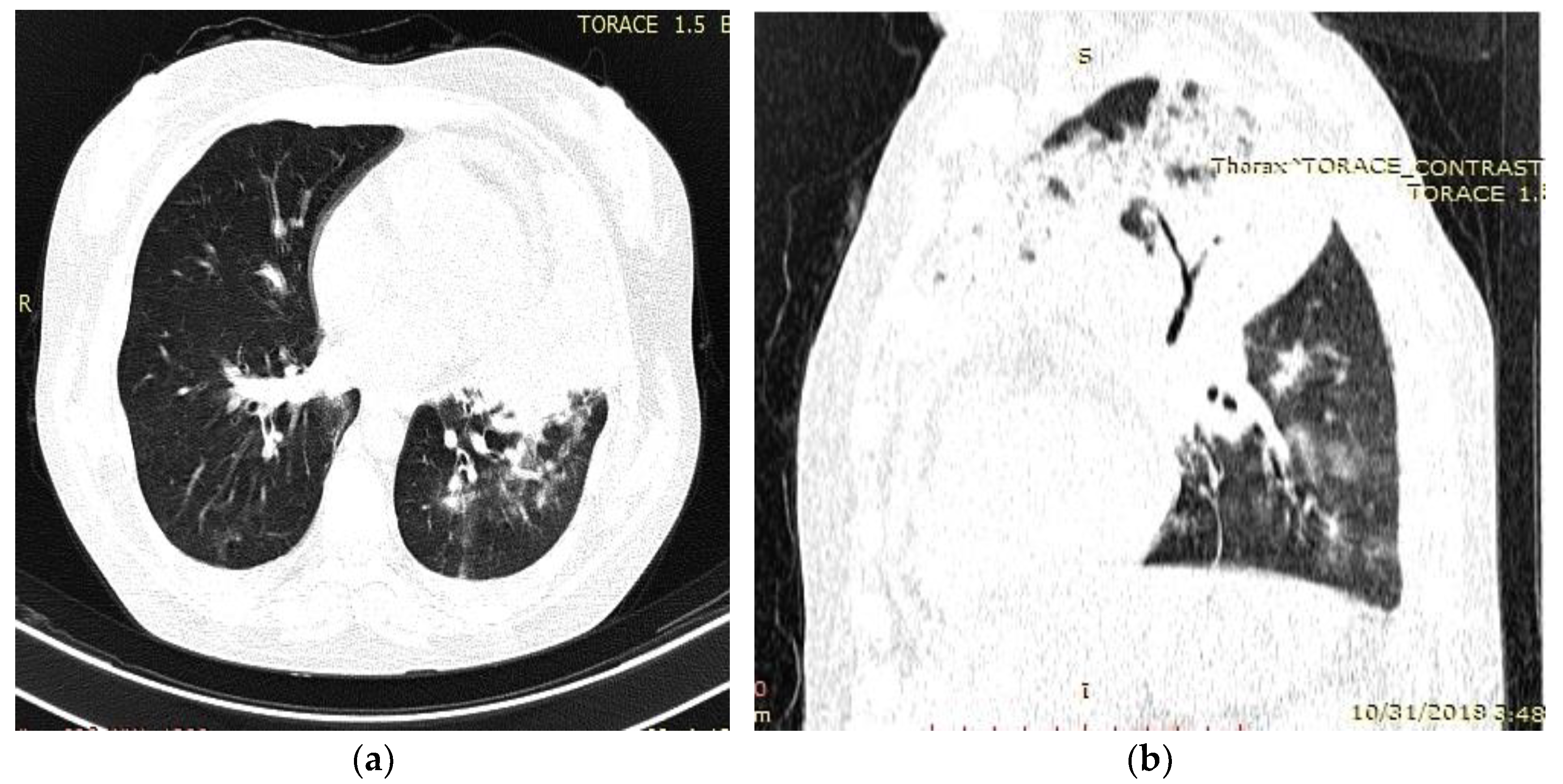 Medicina 59 00806 g002 Medicina 59 00806 g002