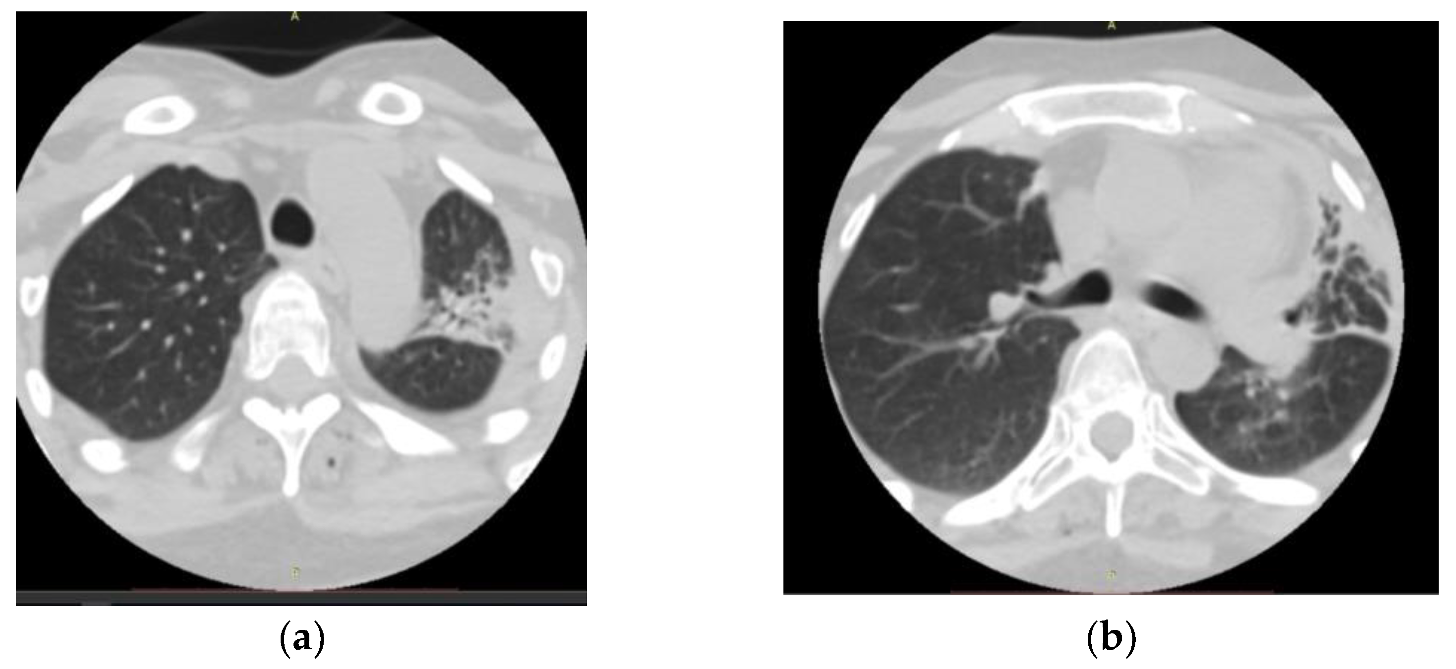 Medicina 59 00806 g003 Medicina 59 00806 g003