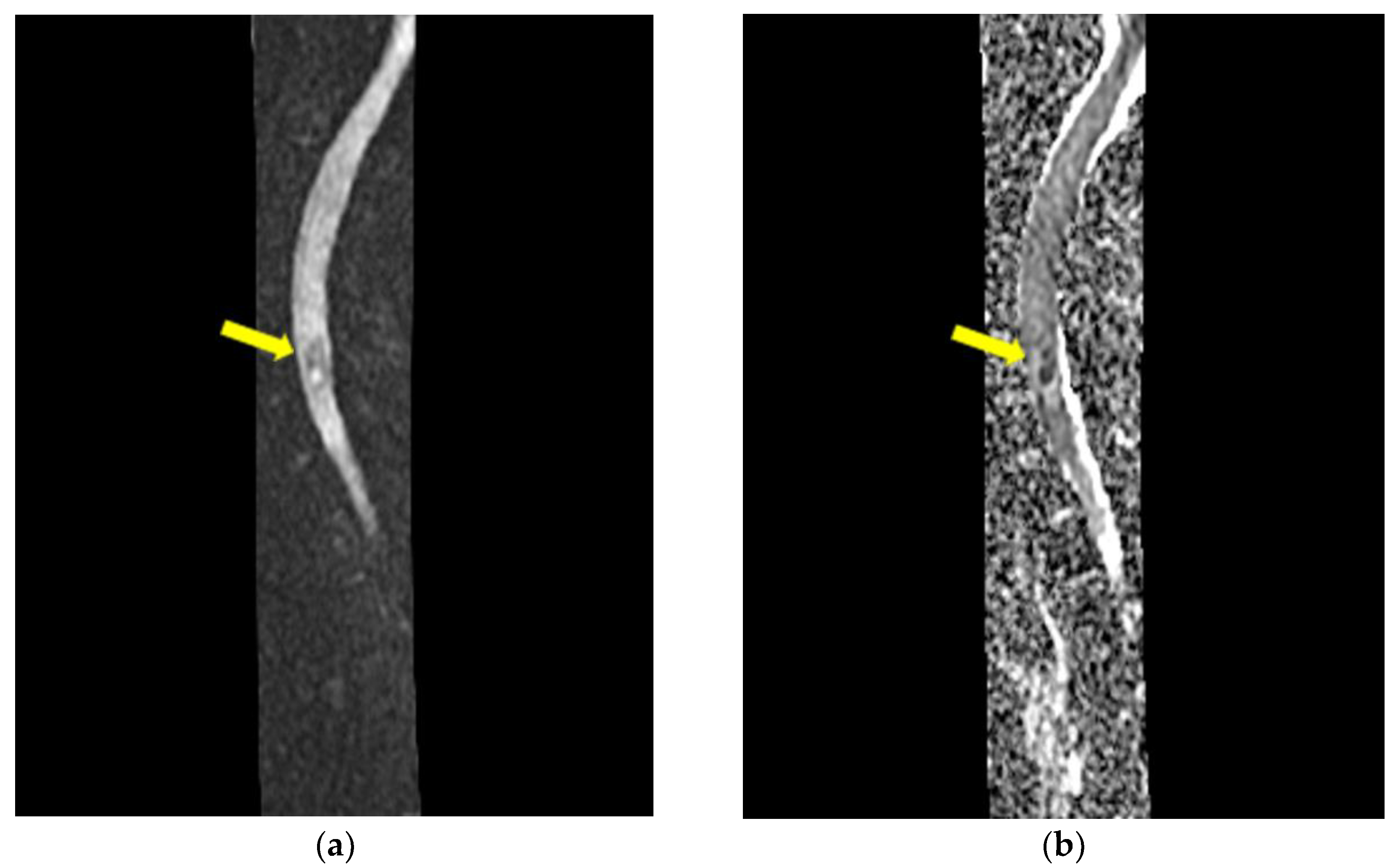 Medicina 59 00806 g005 Medicina 59 00806 g005