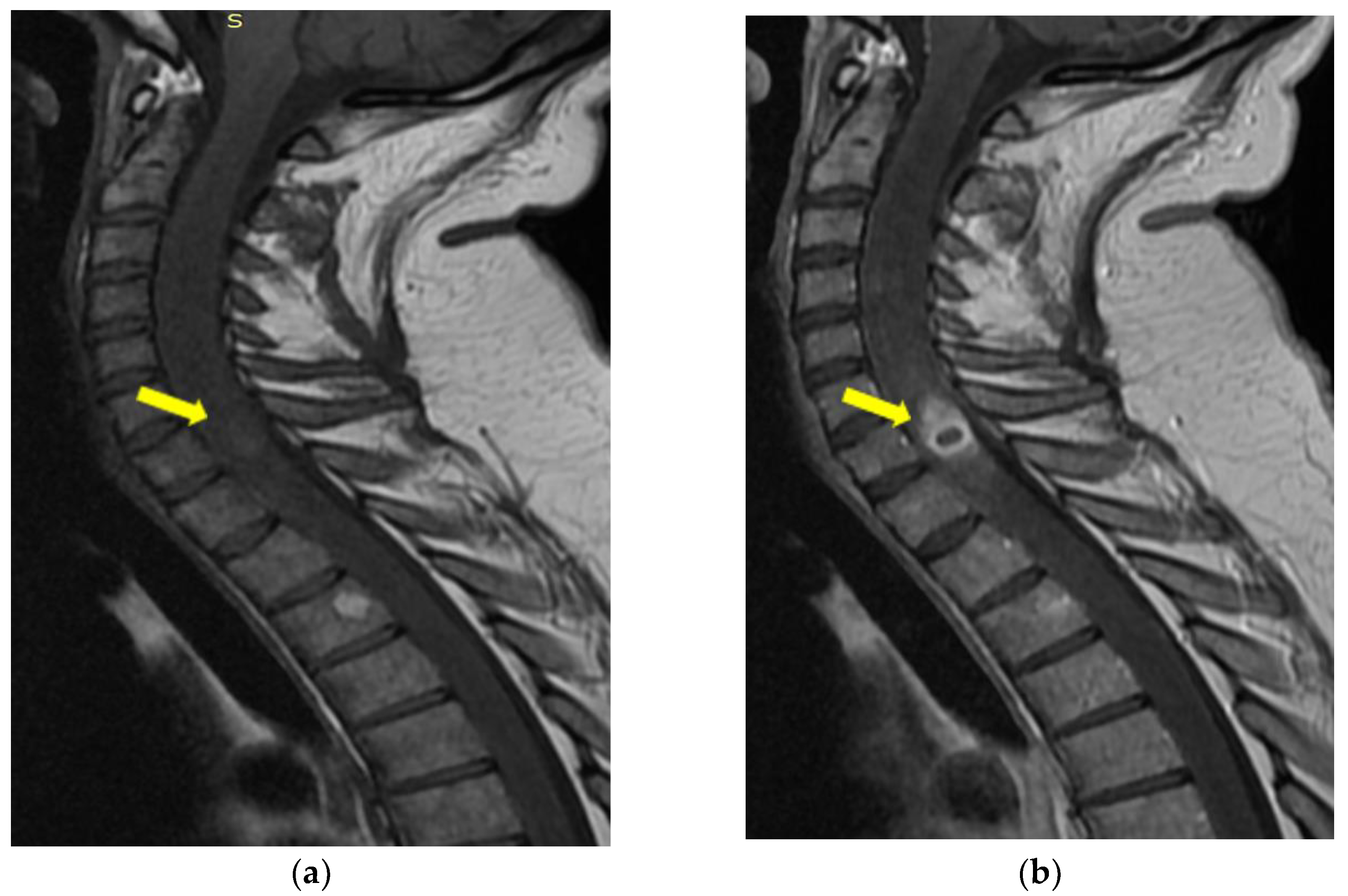 Medicina 59 00806 g006 Medicina 59 00806 g006
