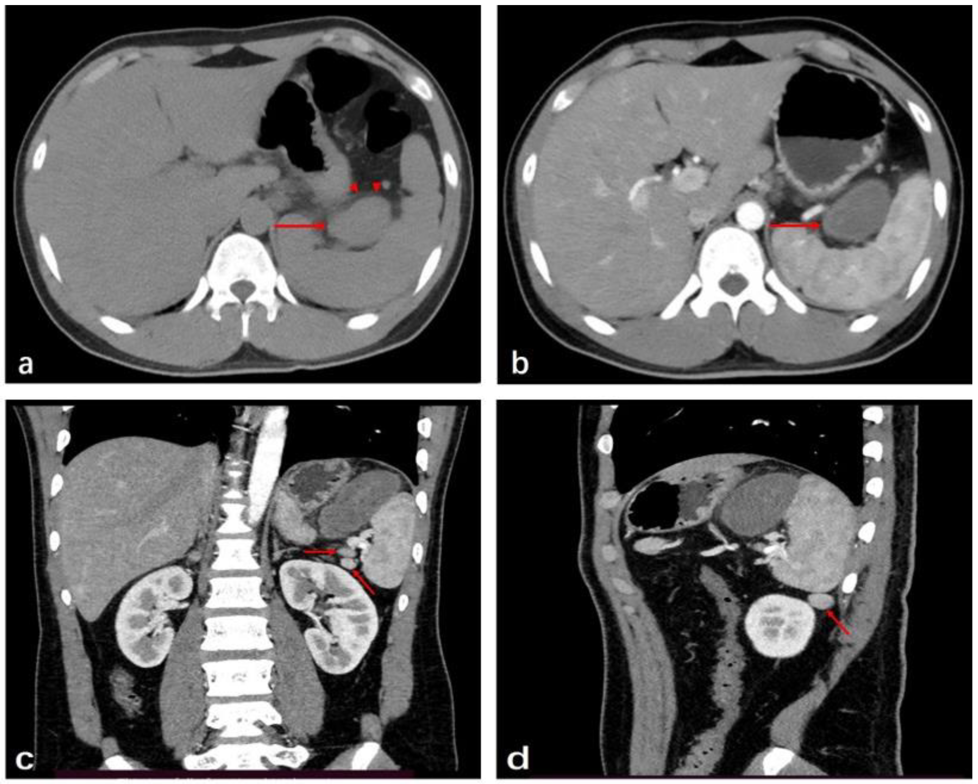 Medicina 59 00807 g001 Medicina 59 00807 g001