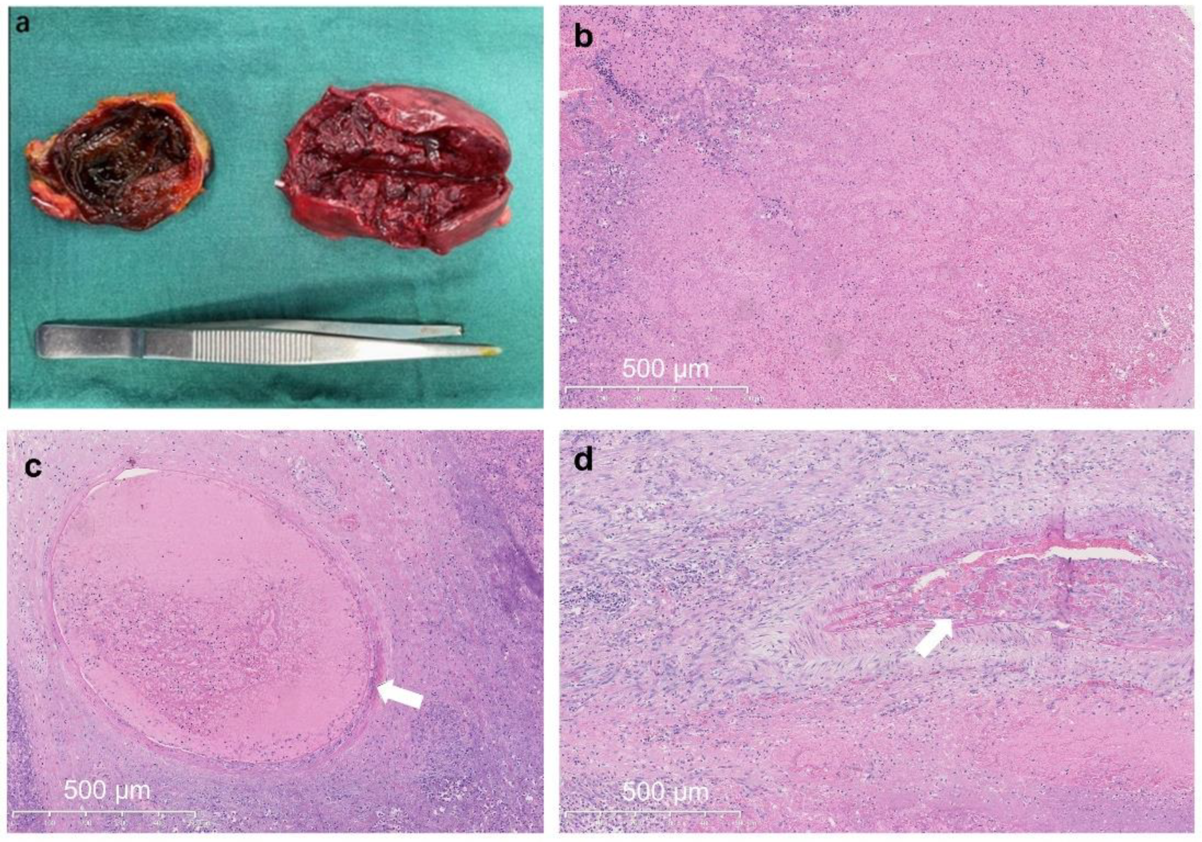 Medicina 59 00807 g004 Medicina 59 00807 g004