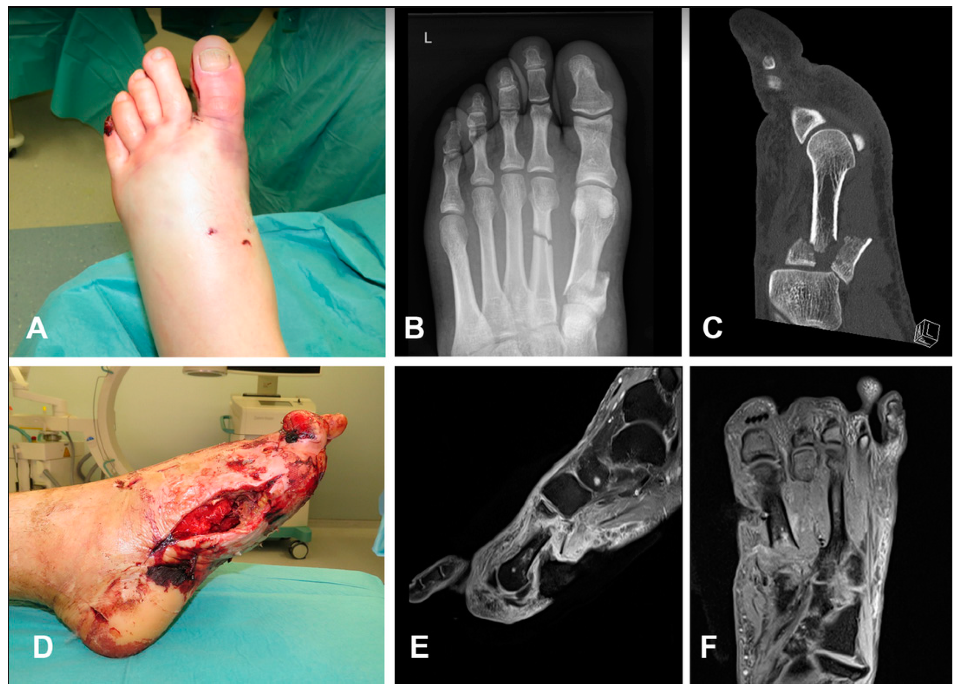 Medicina 59 00859 g002 Medicina 59 00859 g002