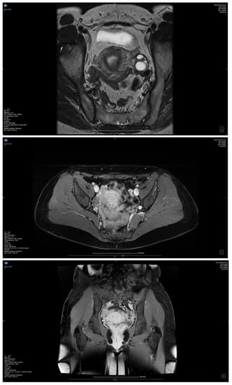 /medicina/medicina-59-00884/article_de