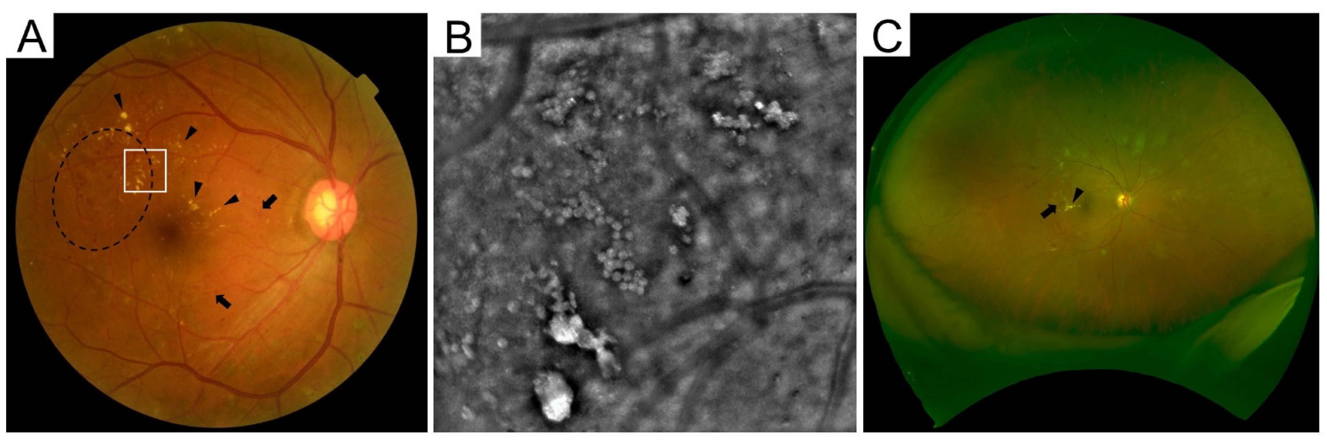 Medicina 59 00896 g002 Medicina 59 00896 g002