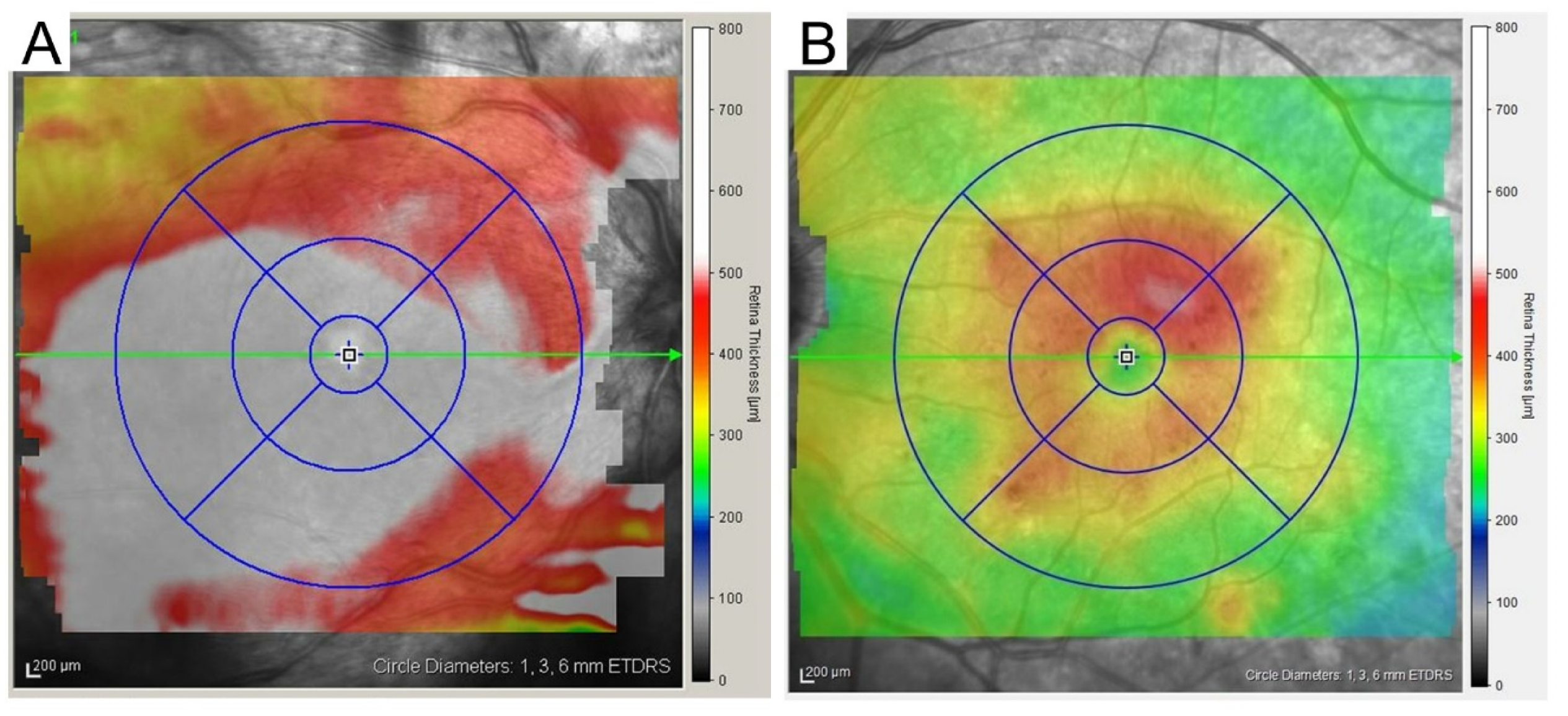 Medicina 59 00896 g004 Medicina 59 00896 g004