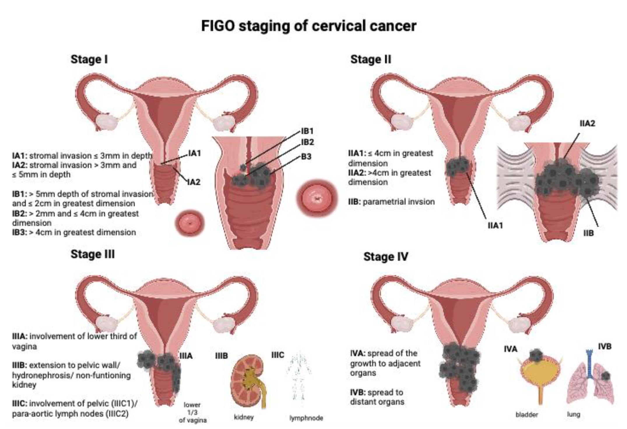 Cervical Cancer Challenge