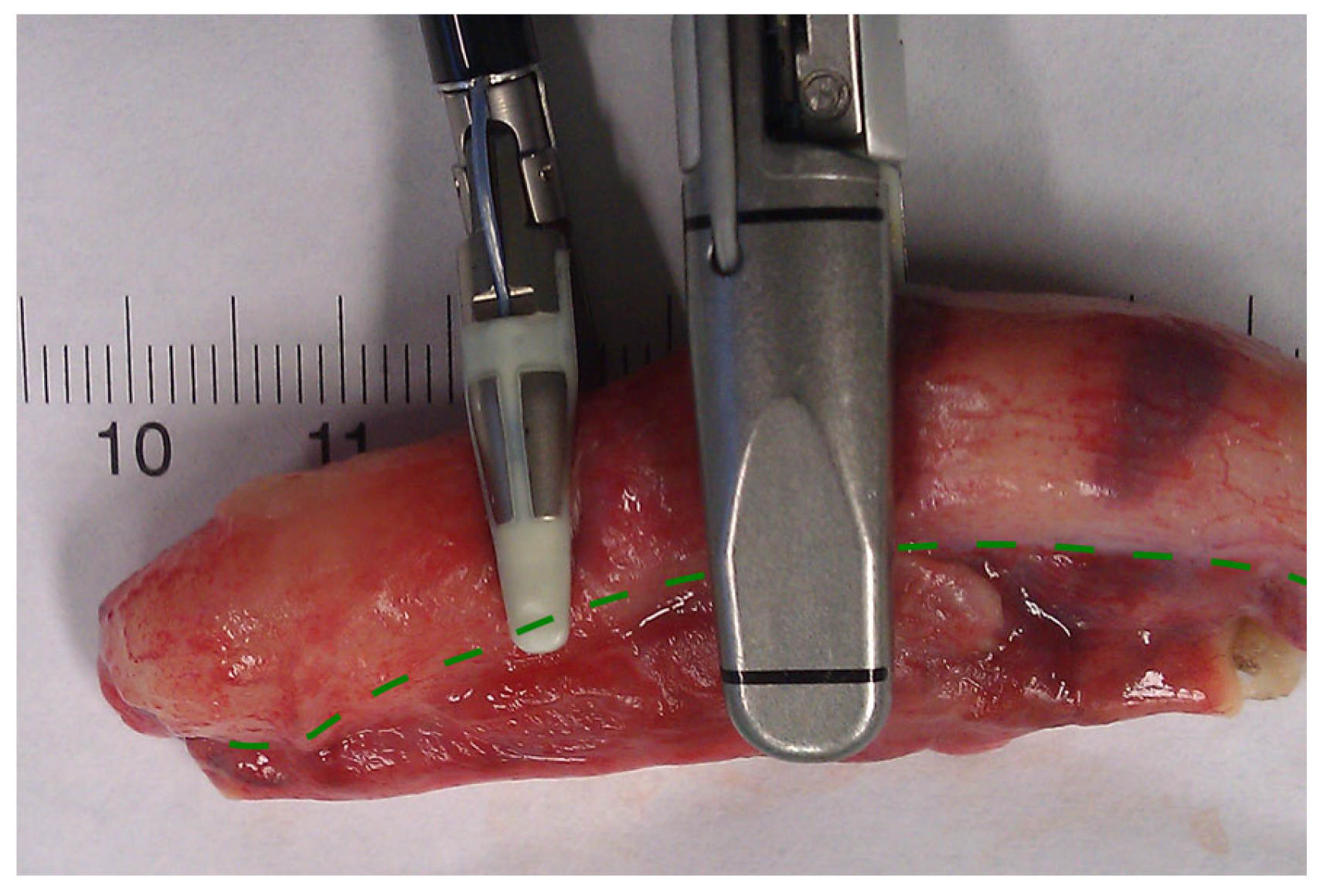 Medicina 59 00927 g004 Medicina 59 00927 g004