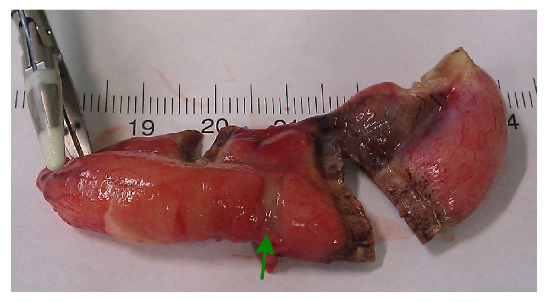 Medicina 59 00927 g005 Medicina 59 00927 g005
