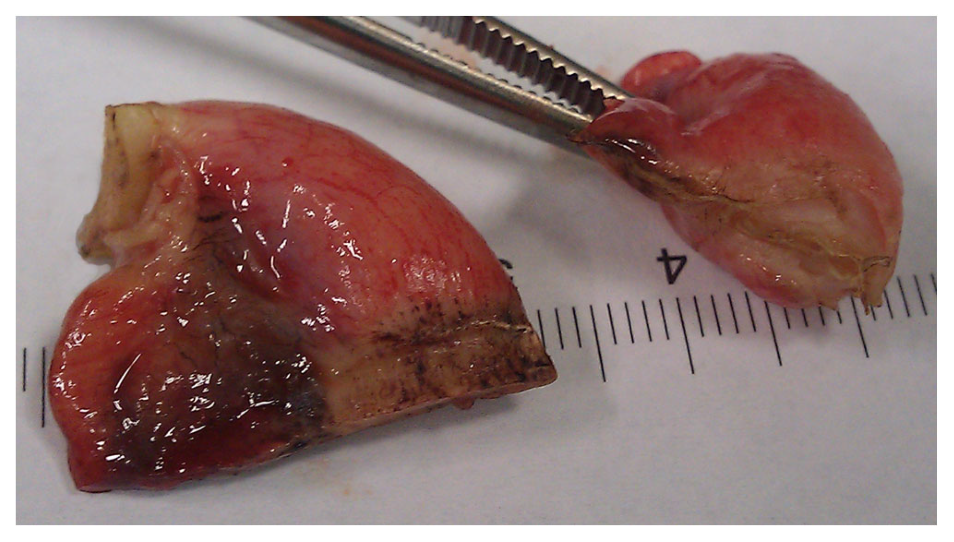 Medicina 59 00927 g006 Medicina 59 00927 g006