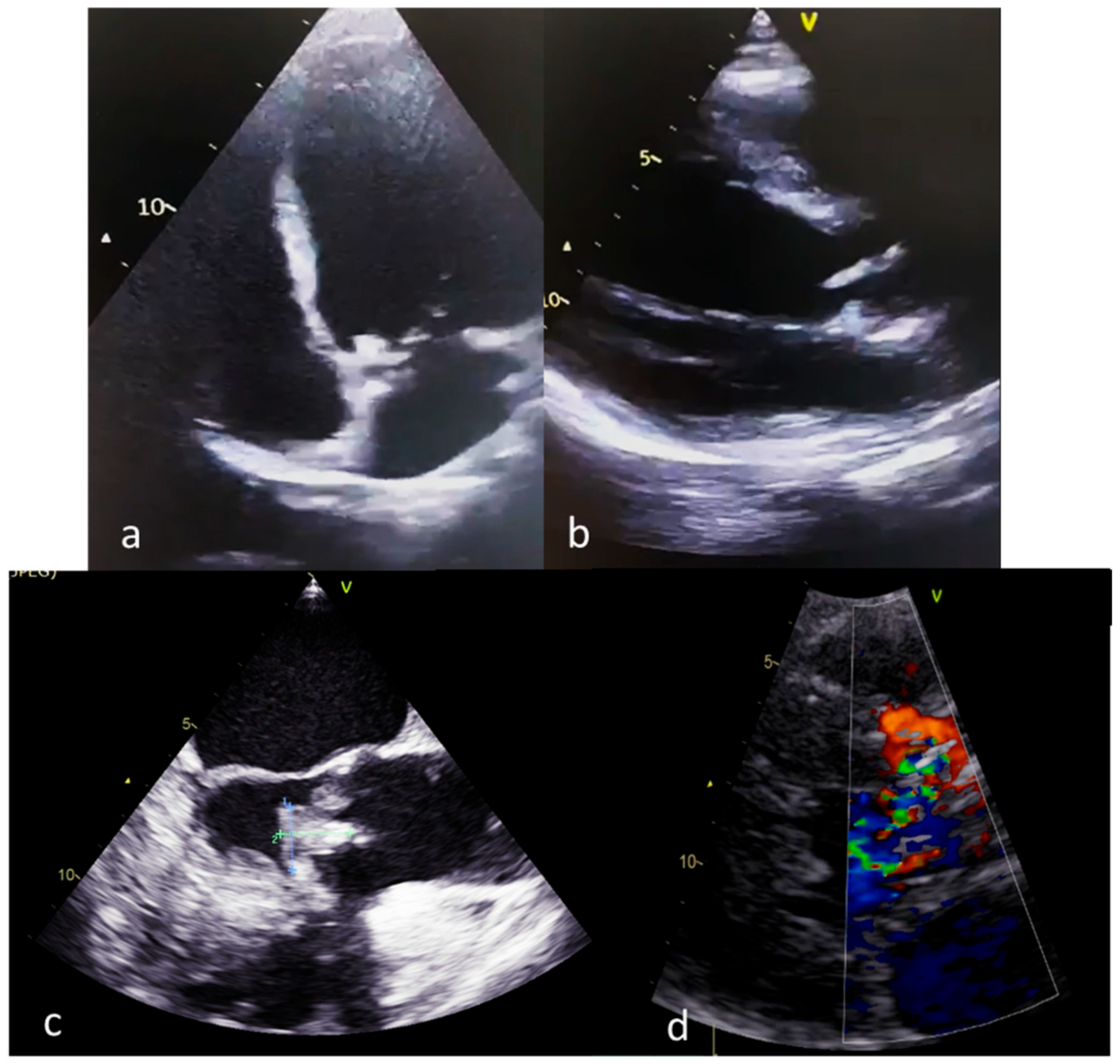 Medicina 59 00939 g003 Medicina 59 00939 g003