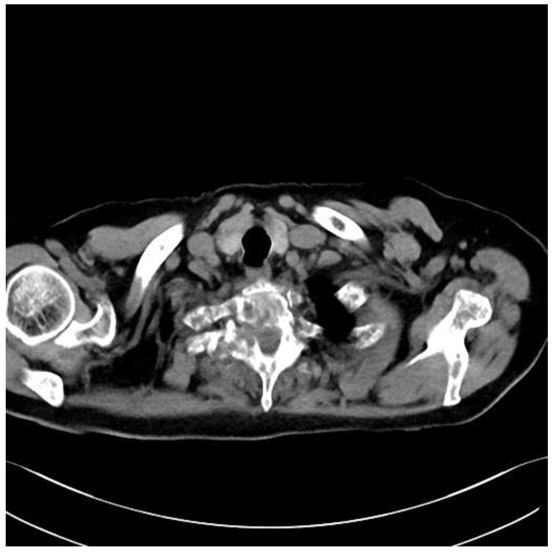 Medicina 59 00993 g003 Medicina 59 00993 g003