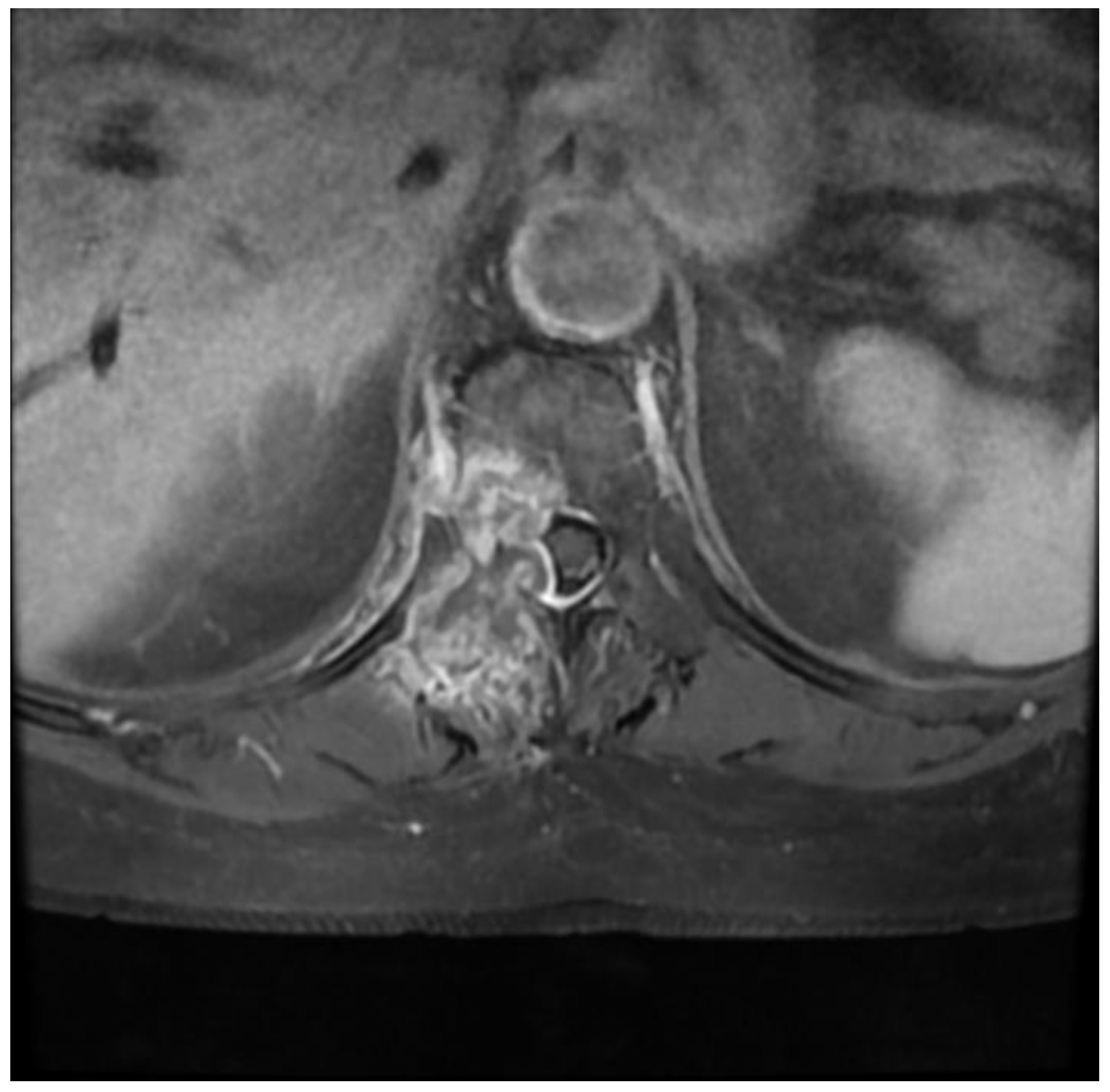 Medicina 59 00993 g004 Medicina 59 00993 g004
