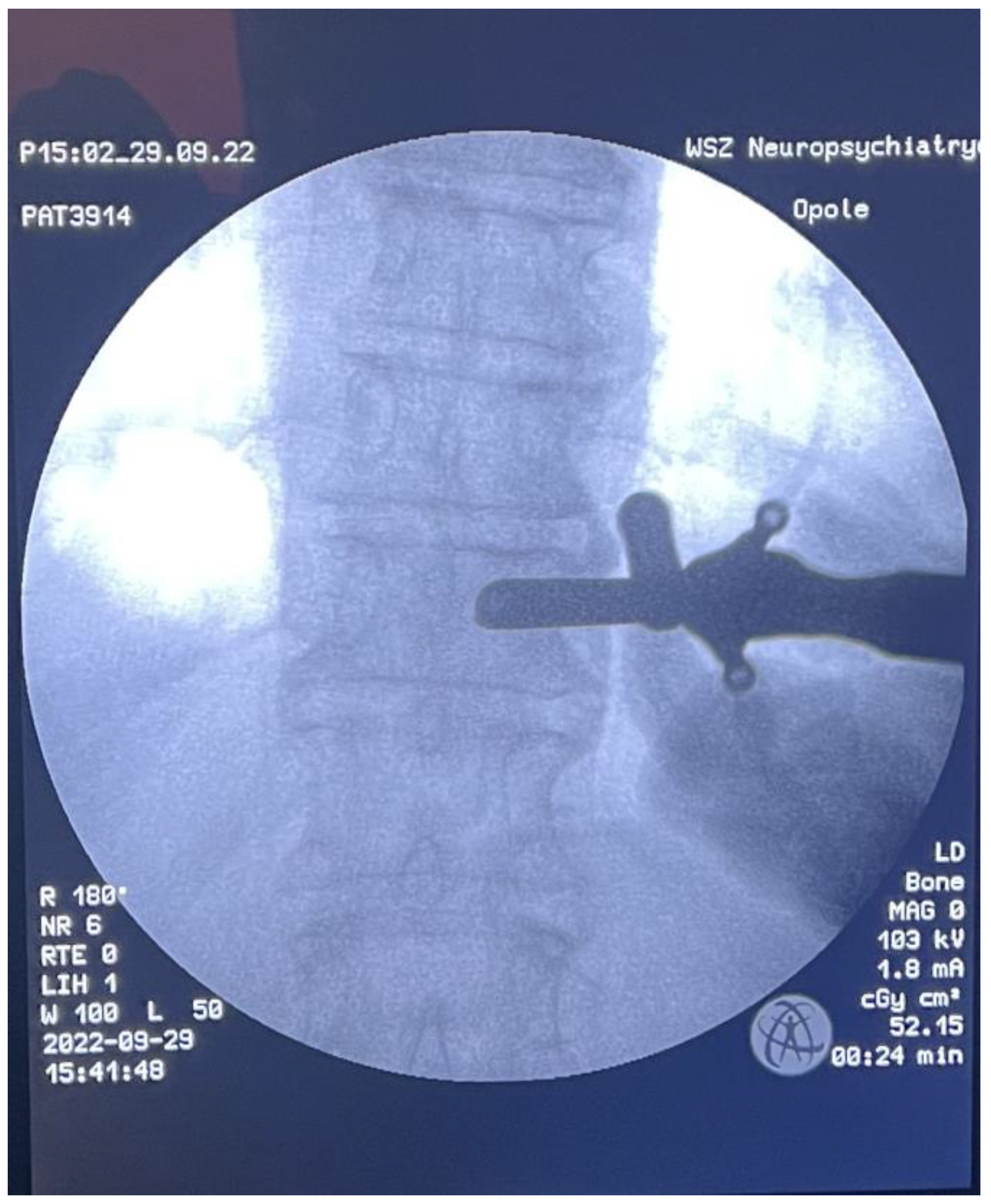 Medicina 59 00993 g005 Medicina 59 00993 g005