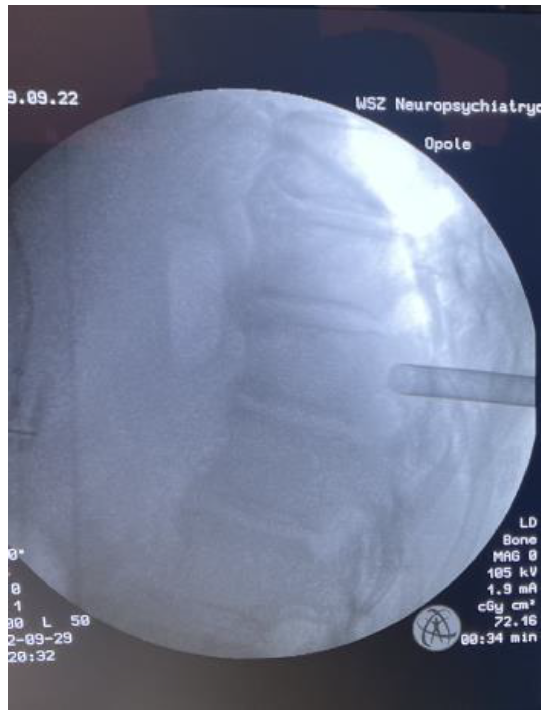 Medicina 59 00993 g006 Medicina 59 00993 g006