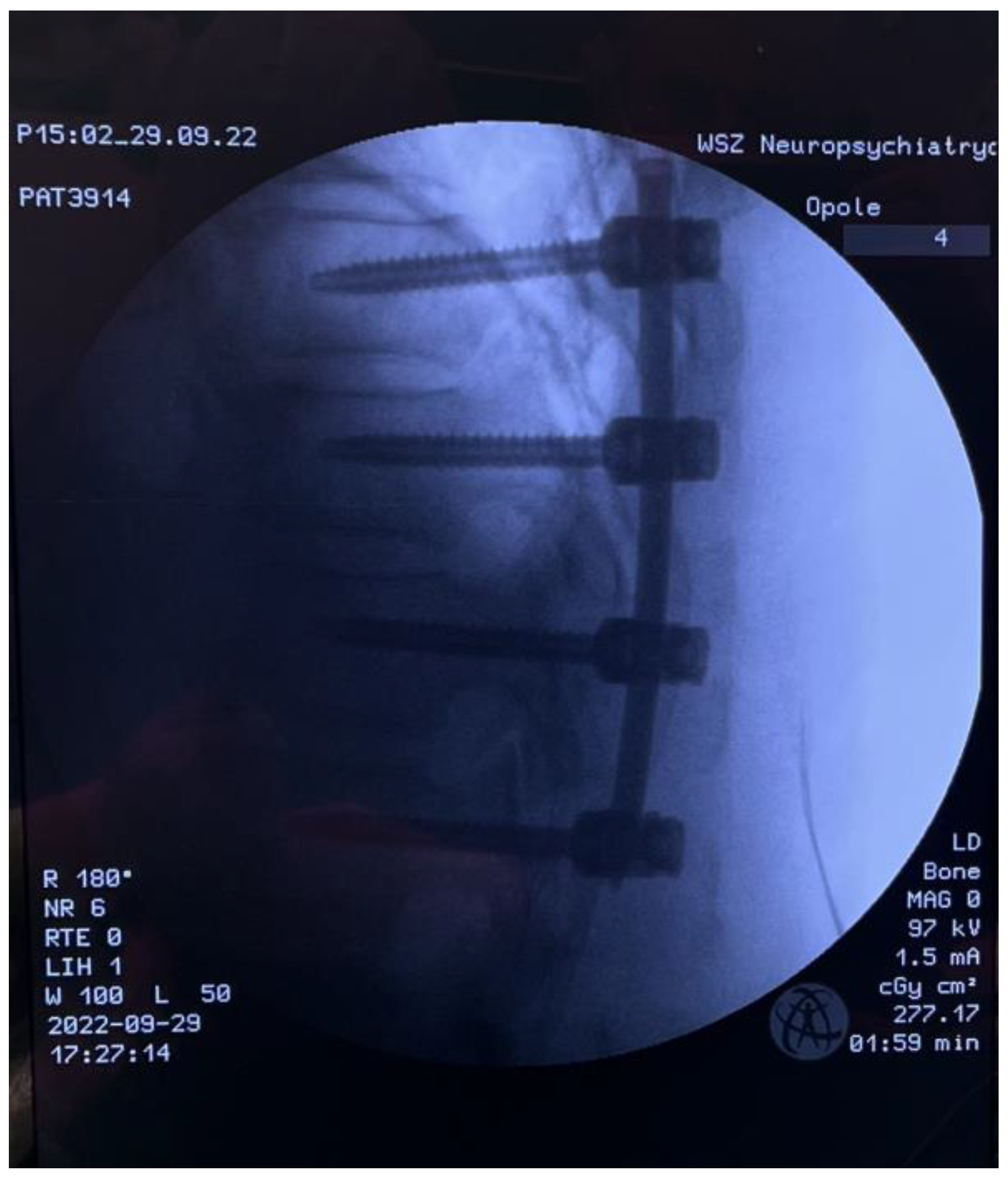 Medicina 59 00993 g007 Medicina 59 00993 g007